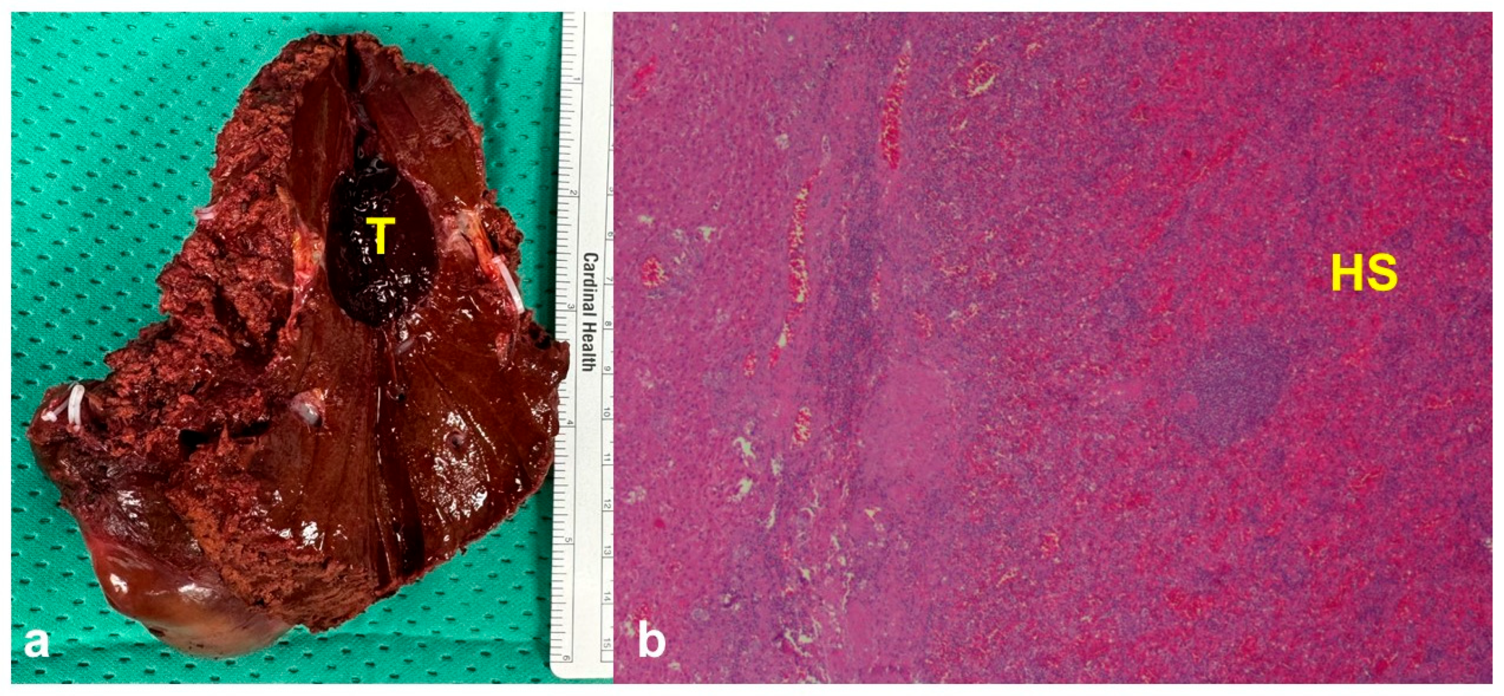 Diagnostics 15 02442 g004 Diagnostics 15 02442 g004