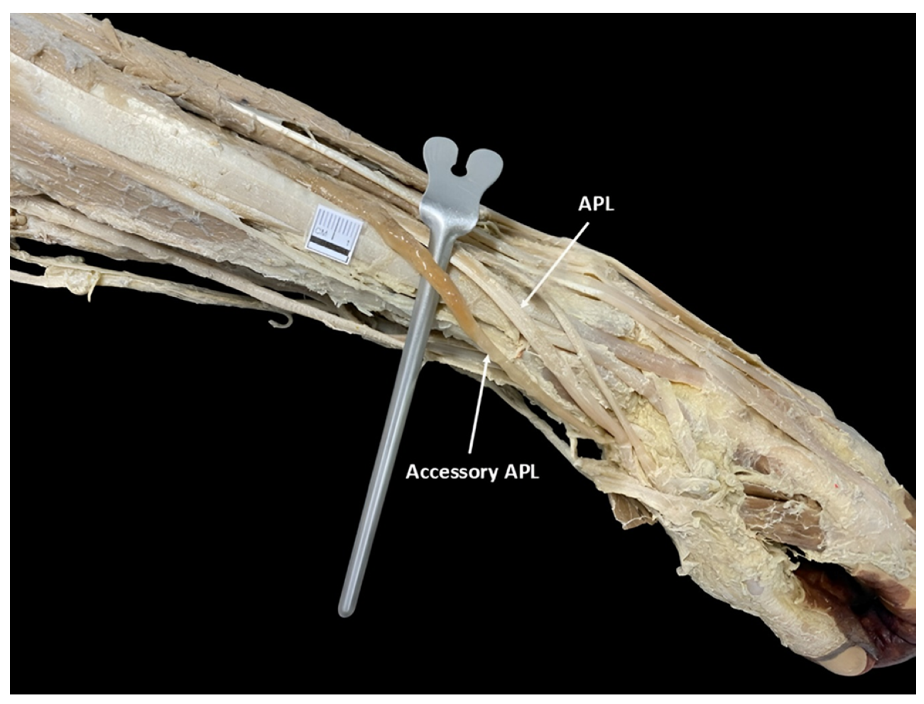 Diagnostics 15 02455 g002 Diagnostics 15 02455 g002
