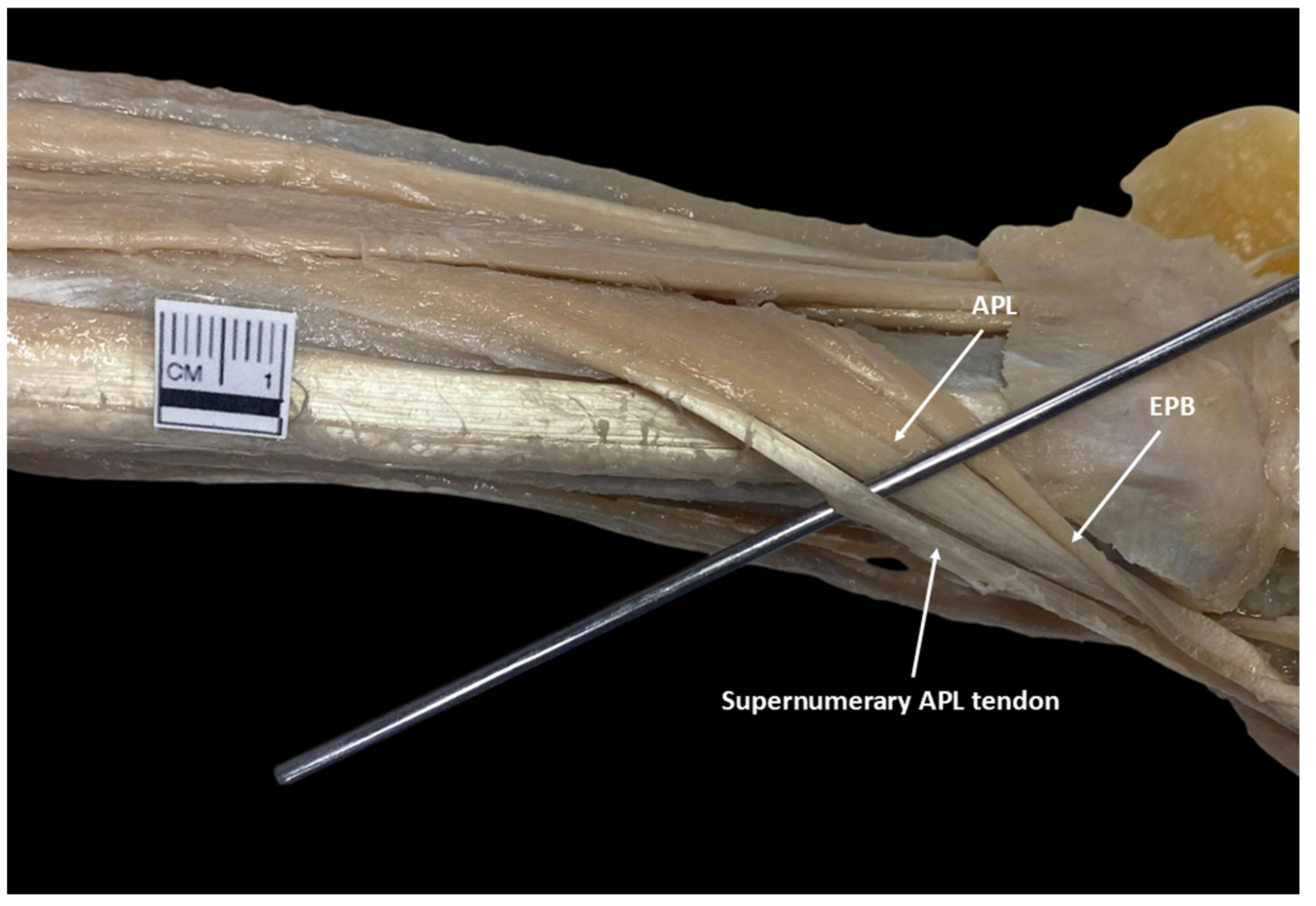 Diagnostics 15 02455 g003 Diagnostics 15 02455 g003