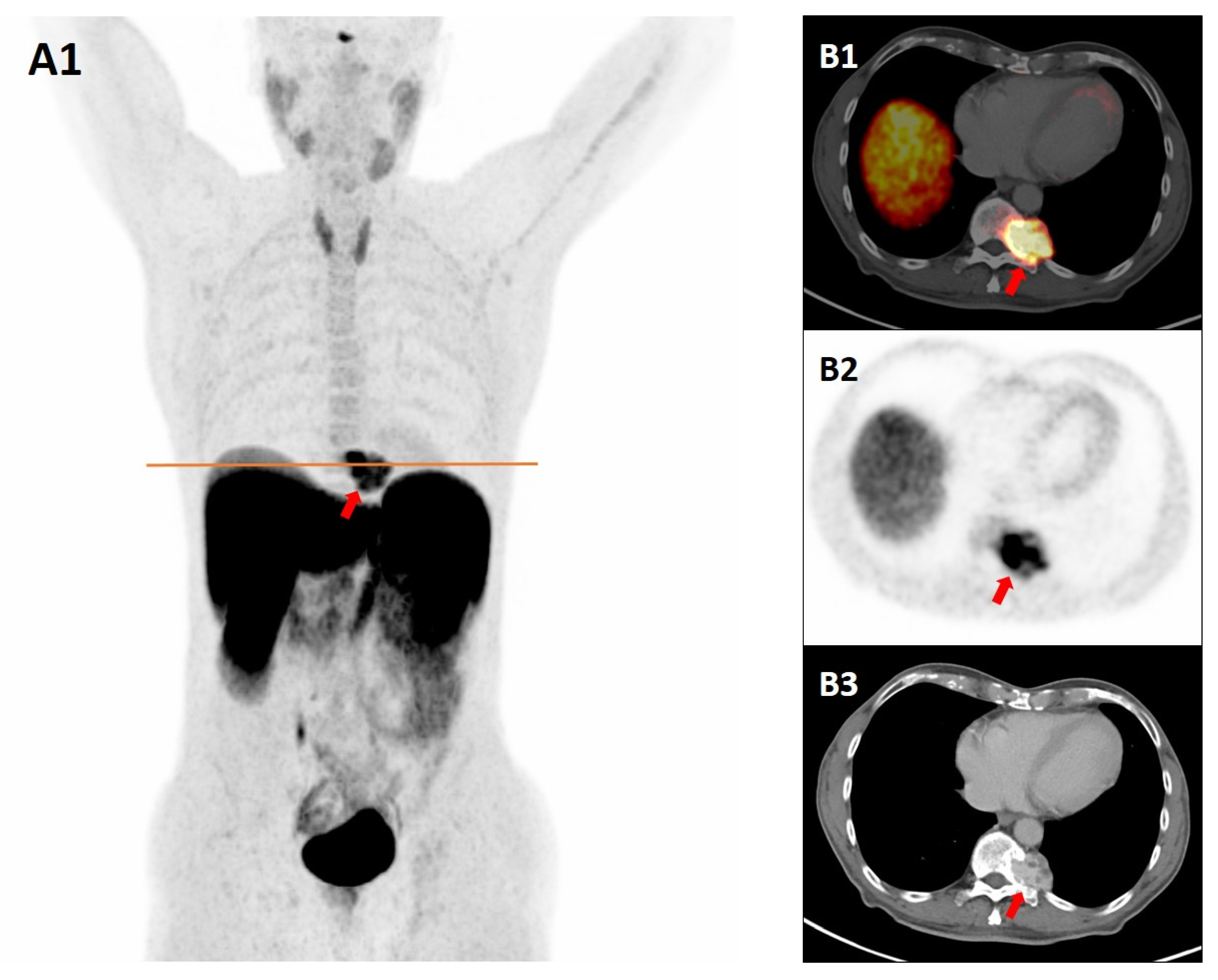 Diagnostics 15 02456 g001 Diagnostics 15 02456 g001
