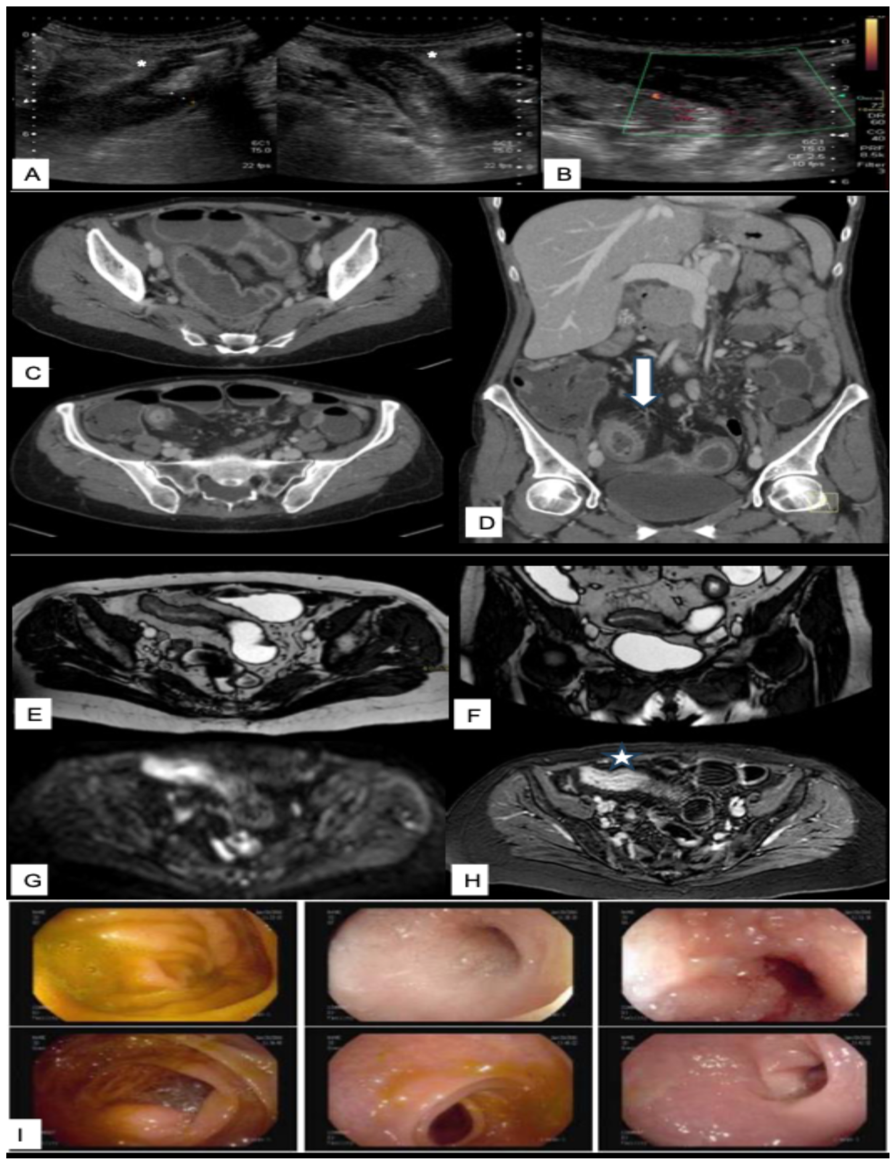 Diagnostics 15 02457 g002 Diagnostics 15 02457 g002