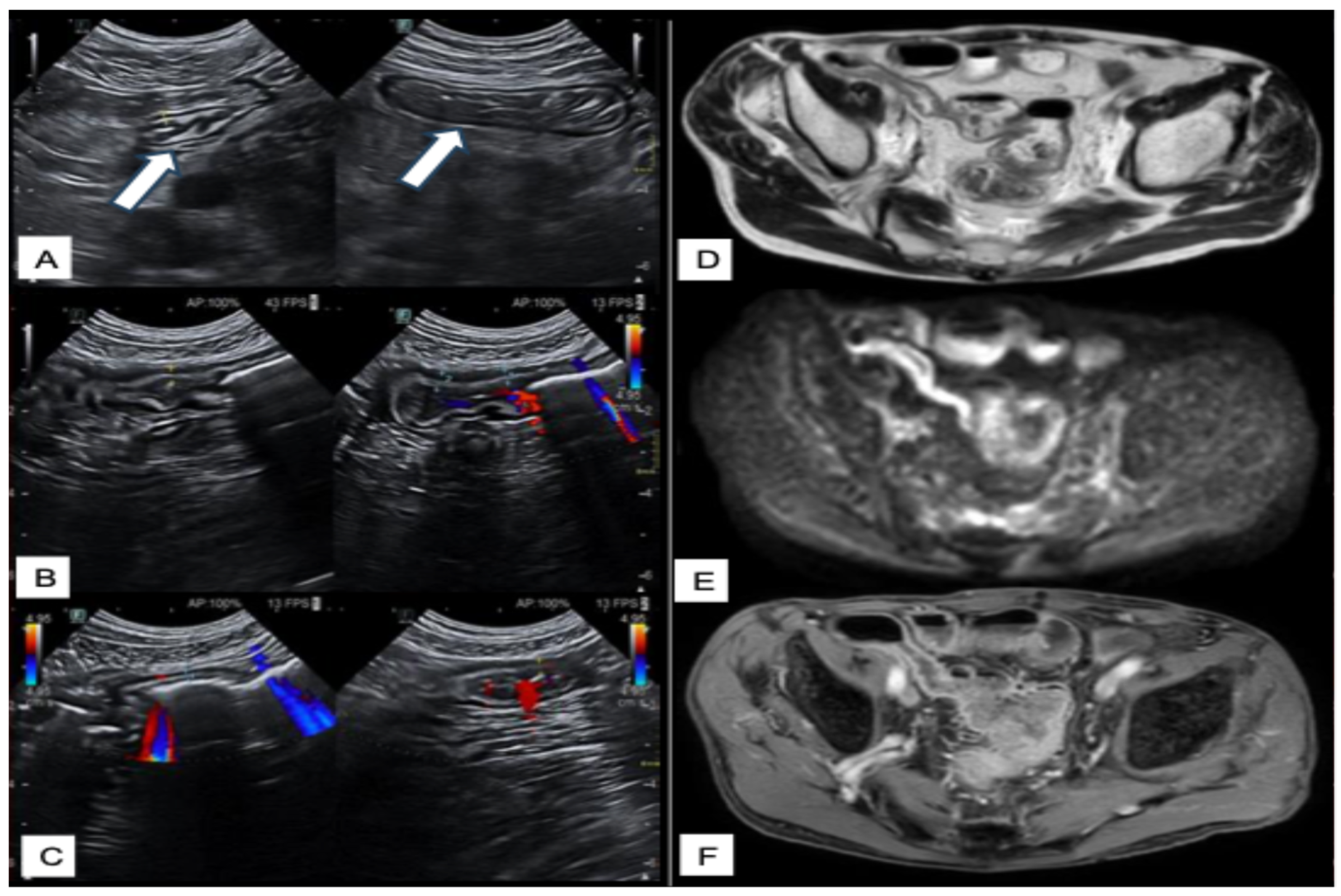 Diagnostics 15 02457 g003 Diagnostics 15 02457 g003