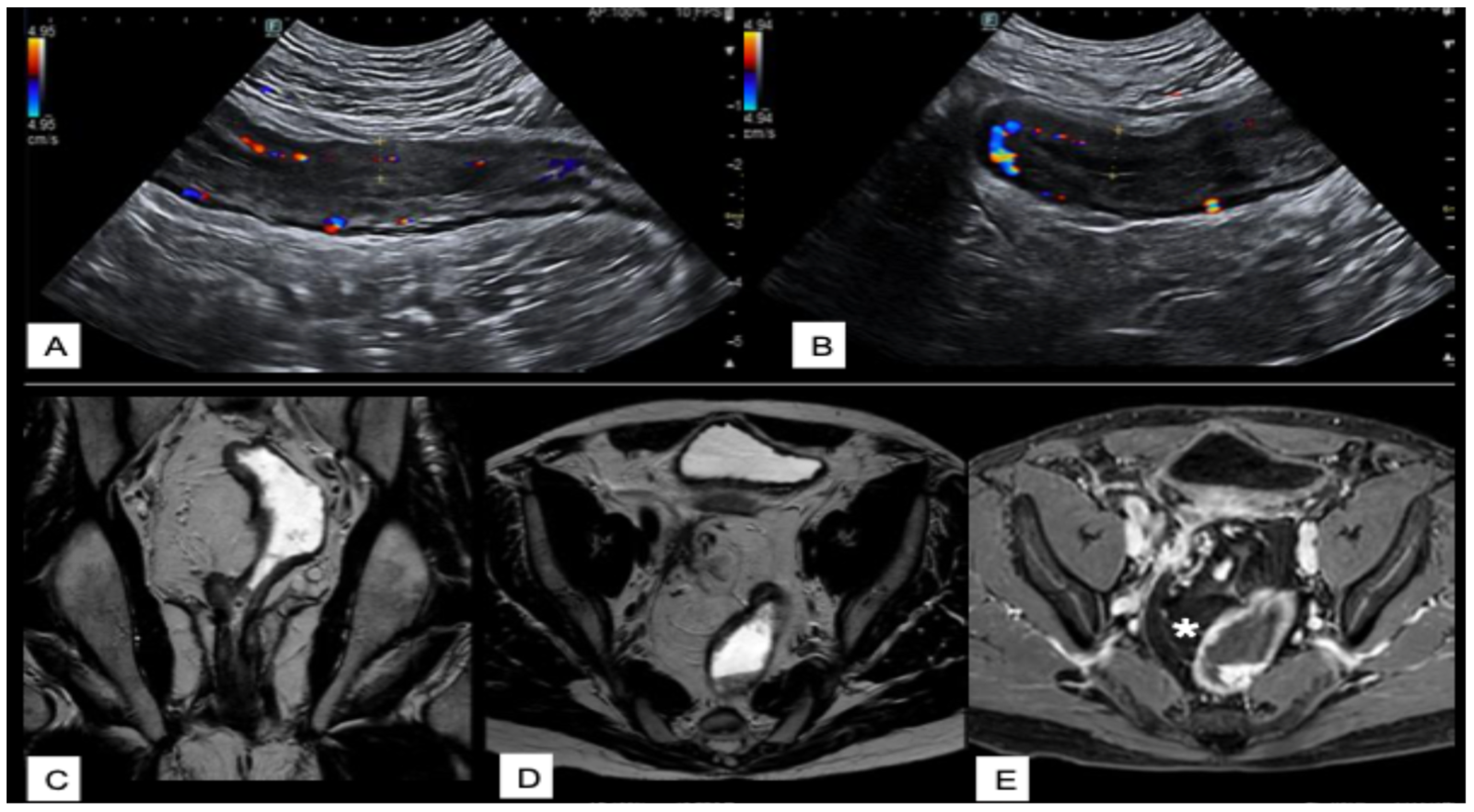 Diagnostics 15 02457 g004 Diagnostics 15 02457 g004