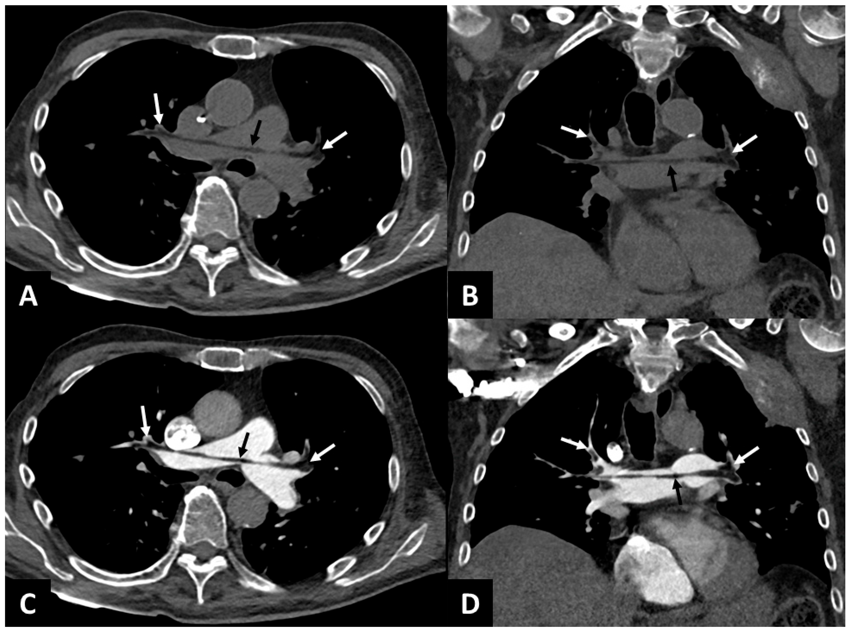 Diagnostics 15 02468 g001 Diagnostics 15 02468 g001