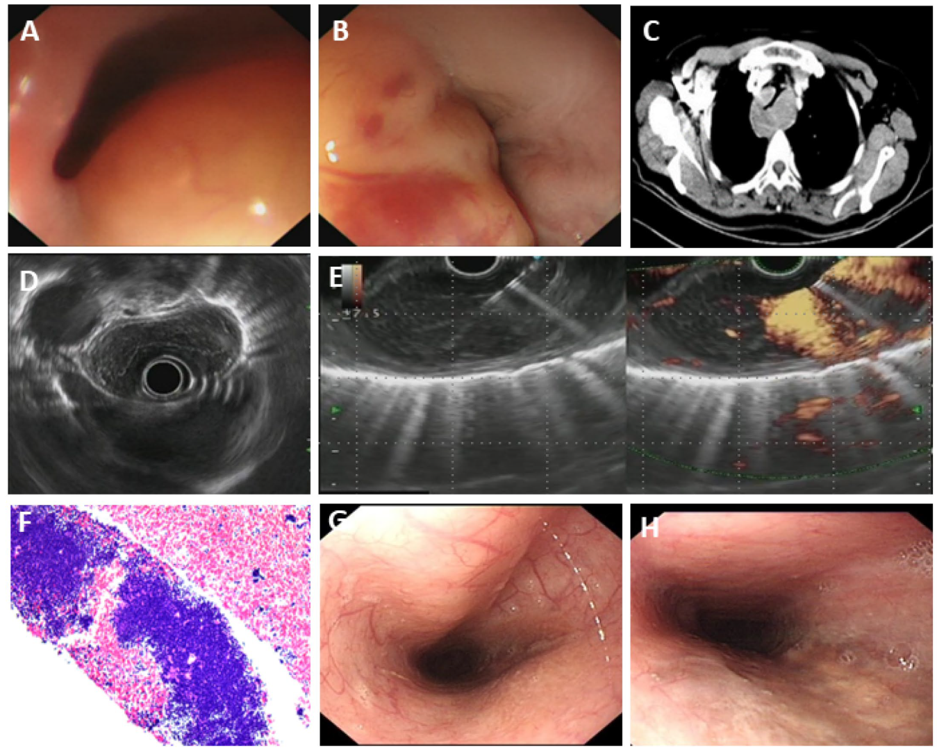 Diagnostics 15 02470 g005