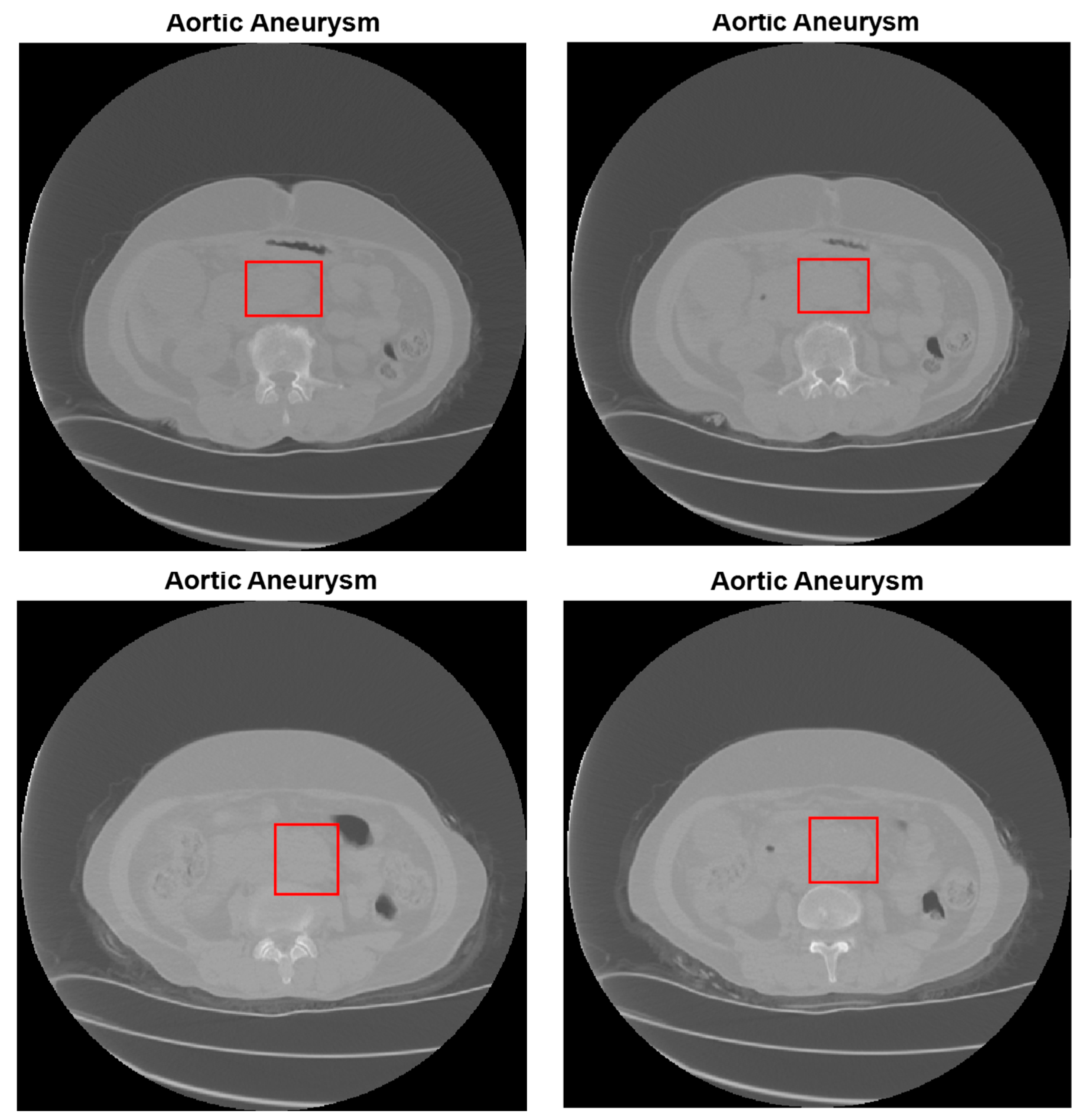 Diagnostics 15 02476 g008 Diagnostics 15 02476 g008