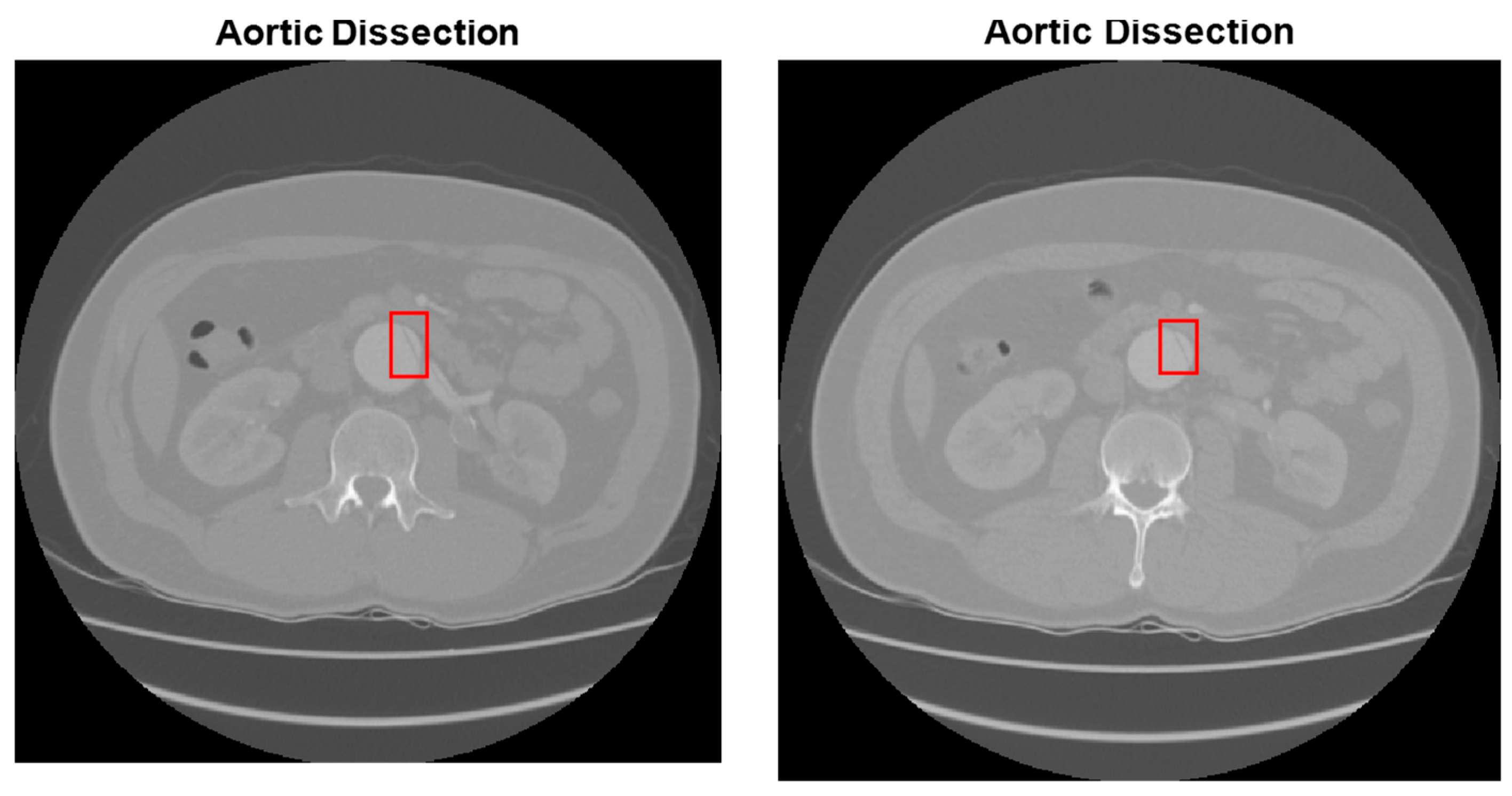 Diagnostics 15 02476 g009b Diagnostics 15 02476 g009b
