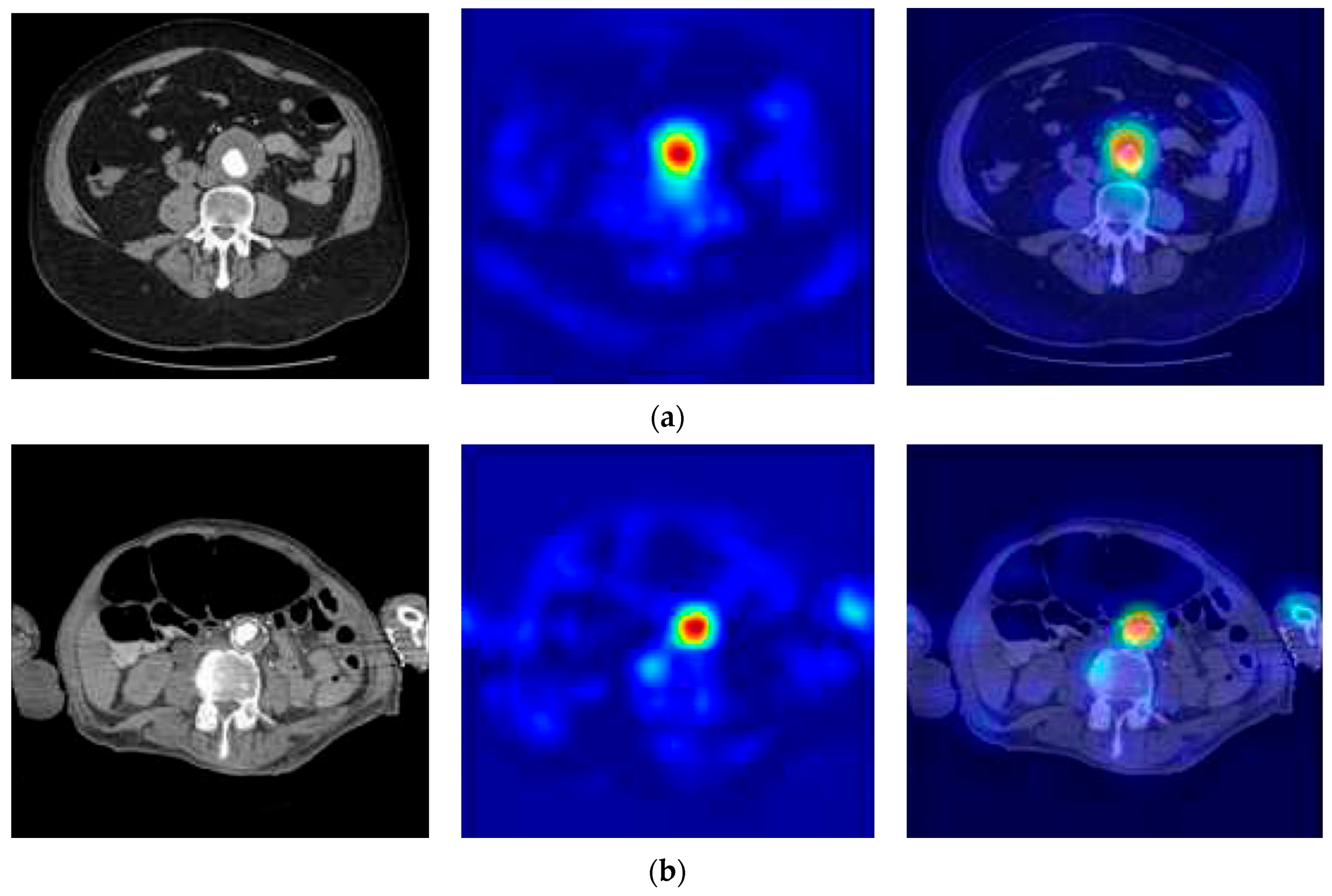 Diagnostics 15 02476 g010 Diagnostics 15 02476 g010