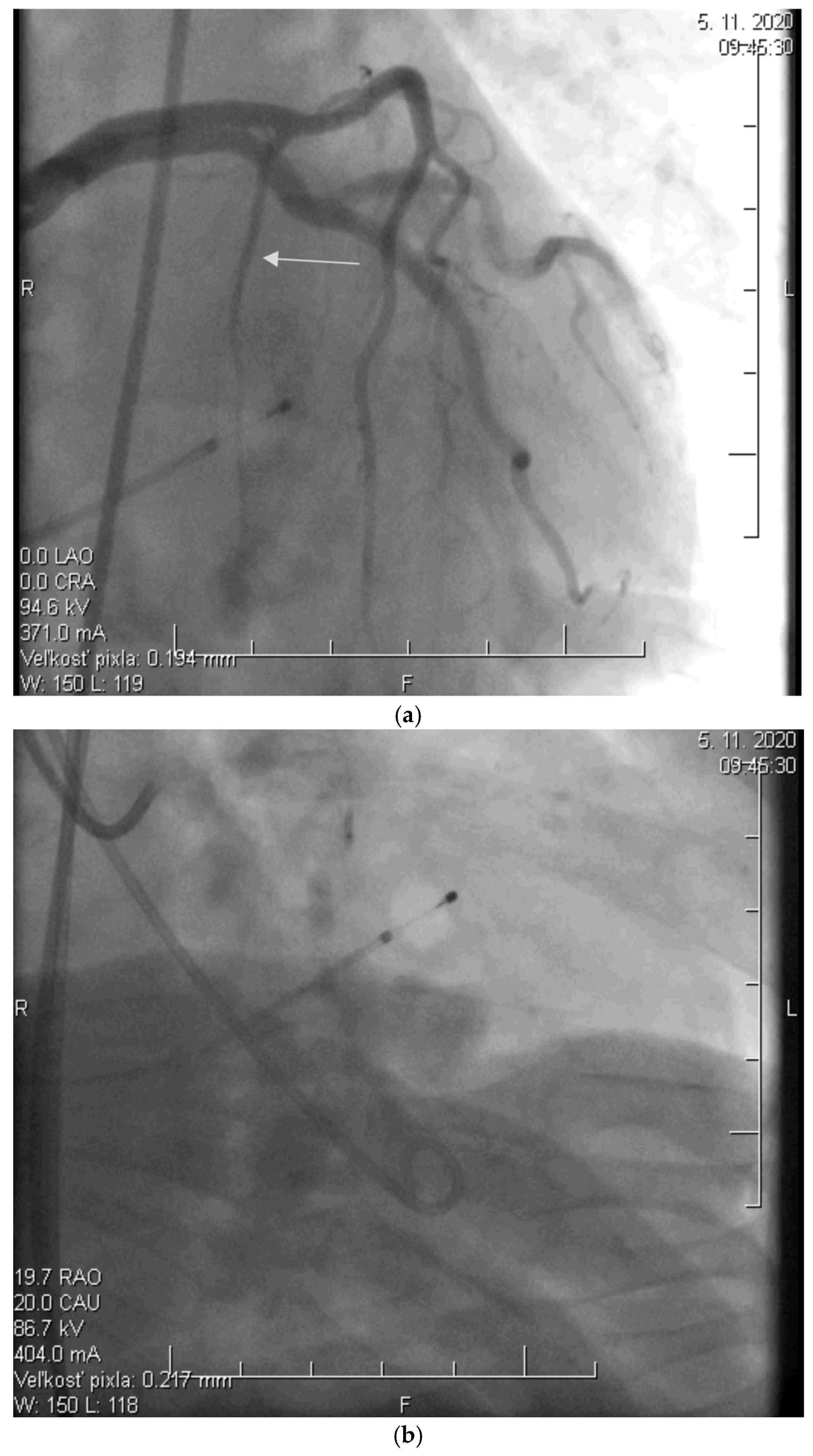 Diagnostics 15 02509 g002a Diagnostics 15 02509 g002a