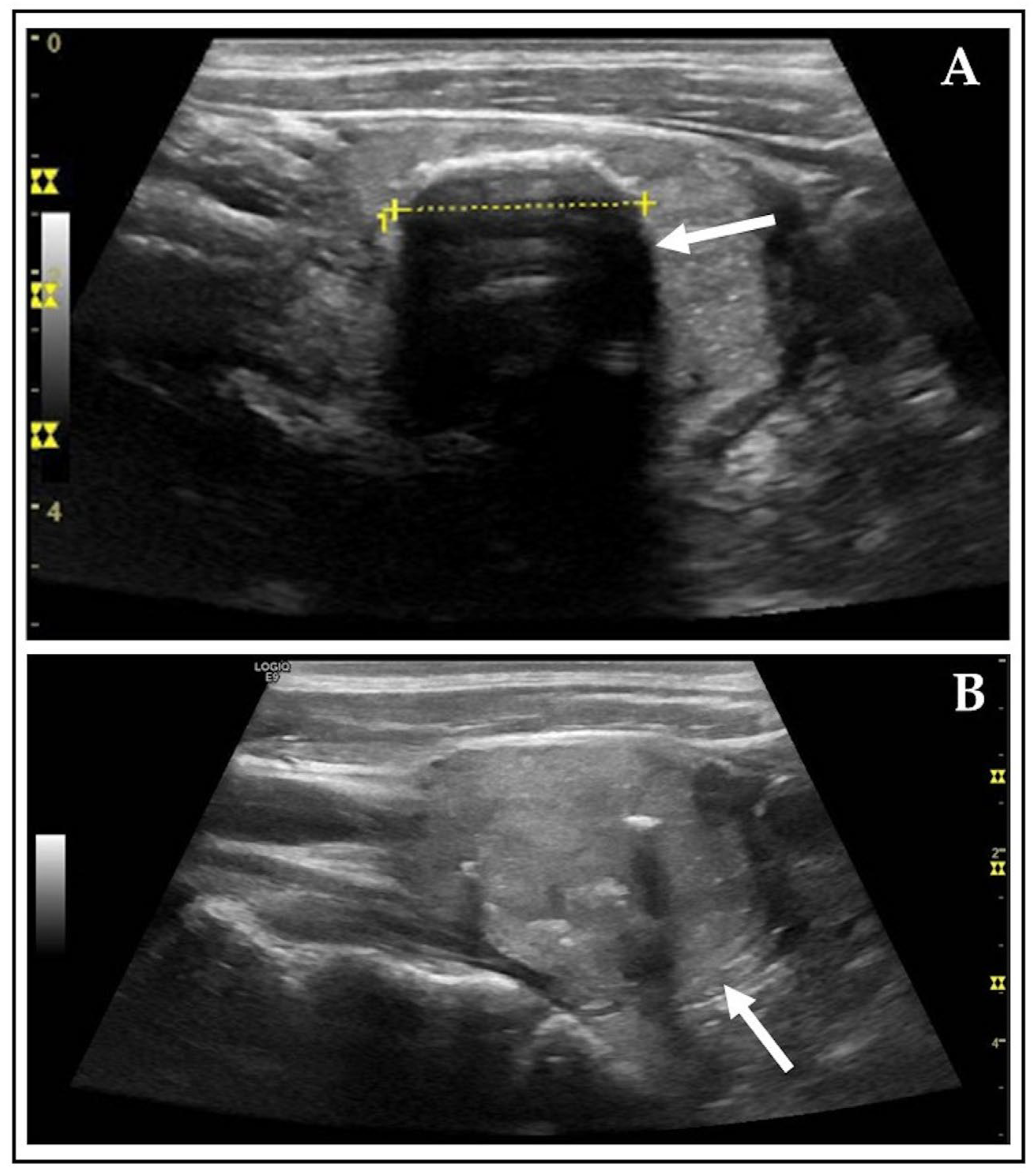 Diagnostics 15 02525 g005