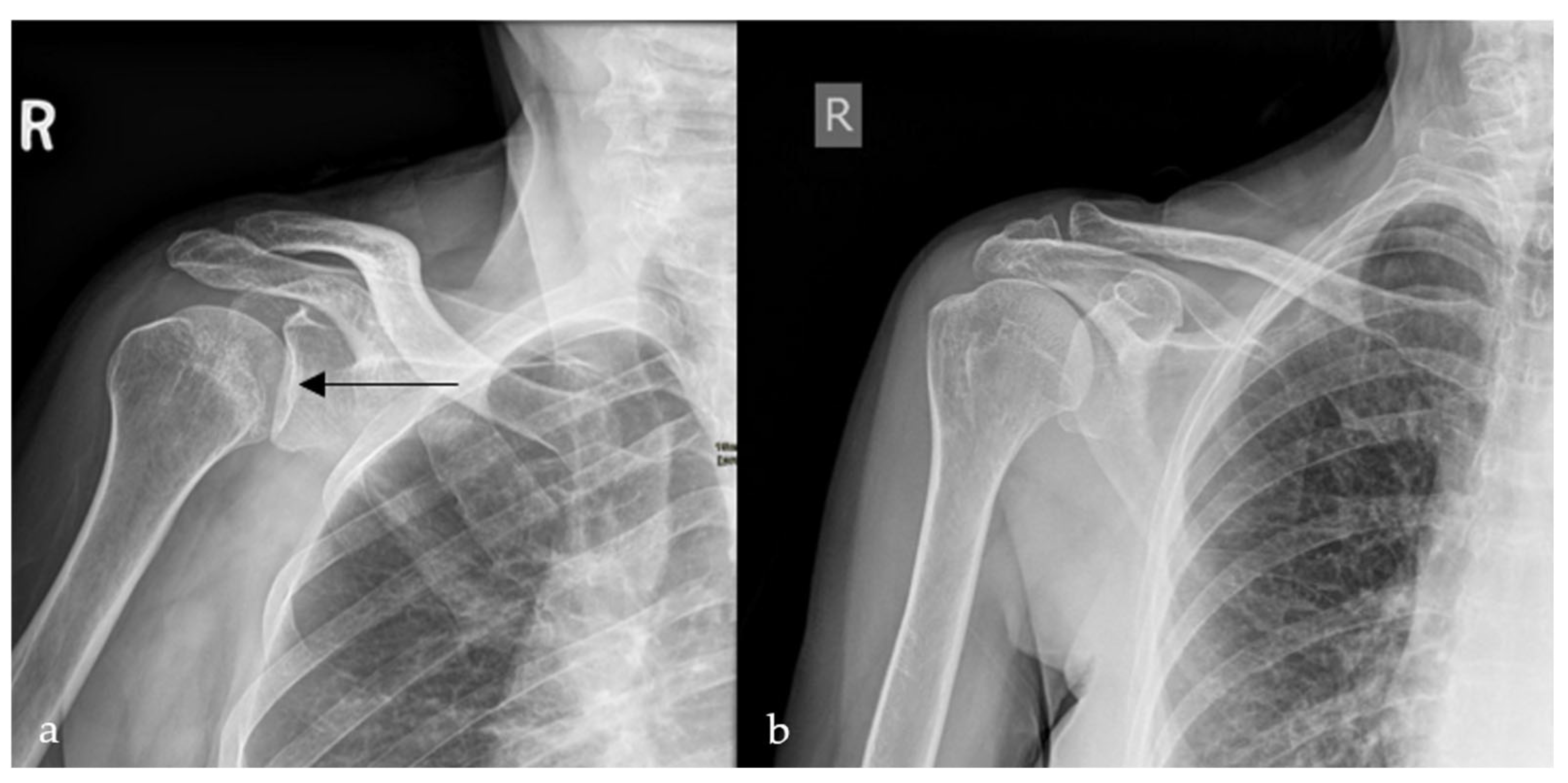 Diagnostics 15 02528 g004 Diagnostics 15 02528 g004