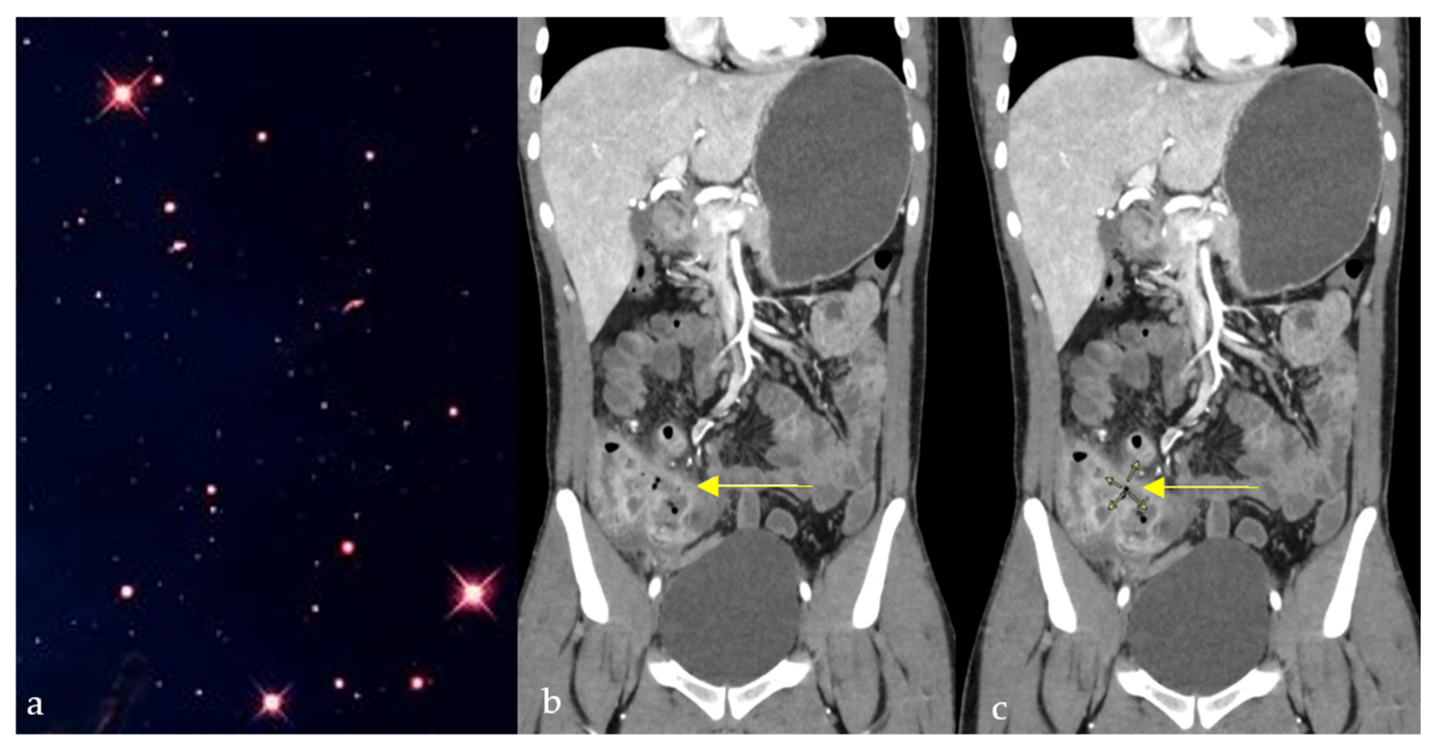 Diagnostics 15 02528 g007 Diagnostics 15 02528 g007
