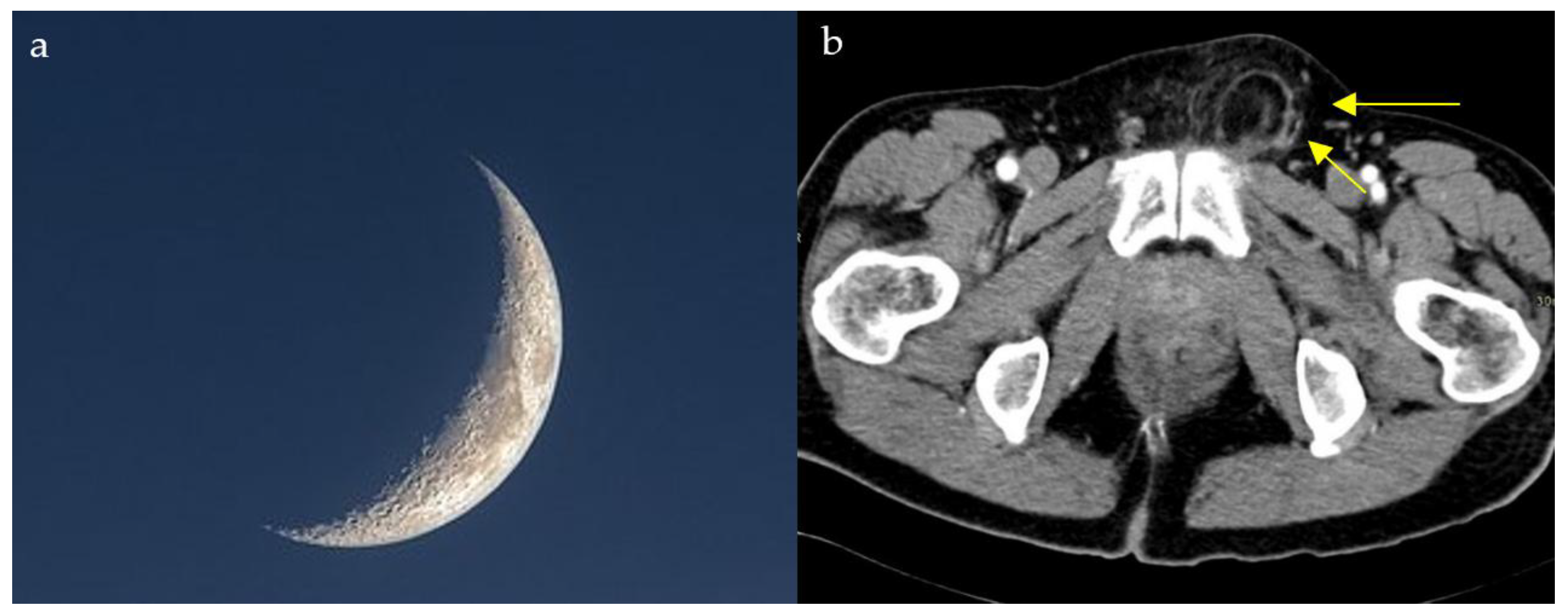 Diagnostics 15 02528 g013 Diagnostics 15 02528 g013