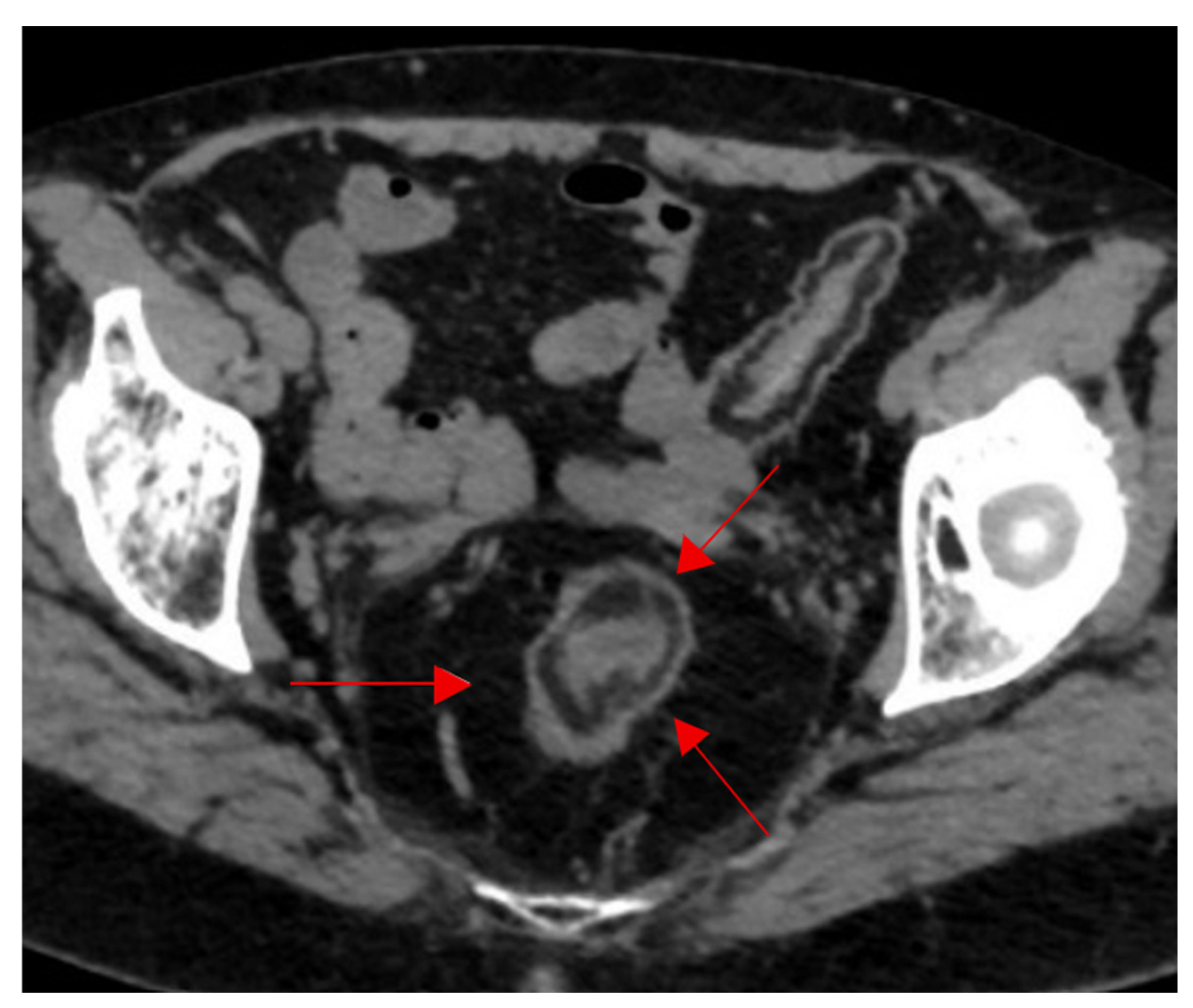 Diagnostics 15 02528 g016 Diagnostics 15 02528 g016