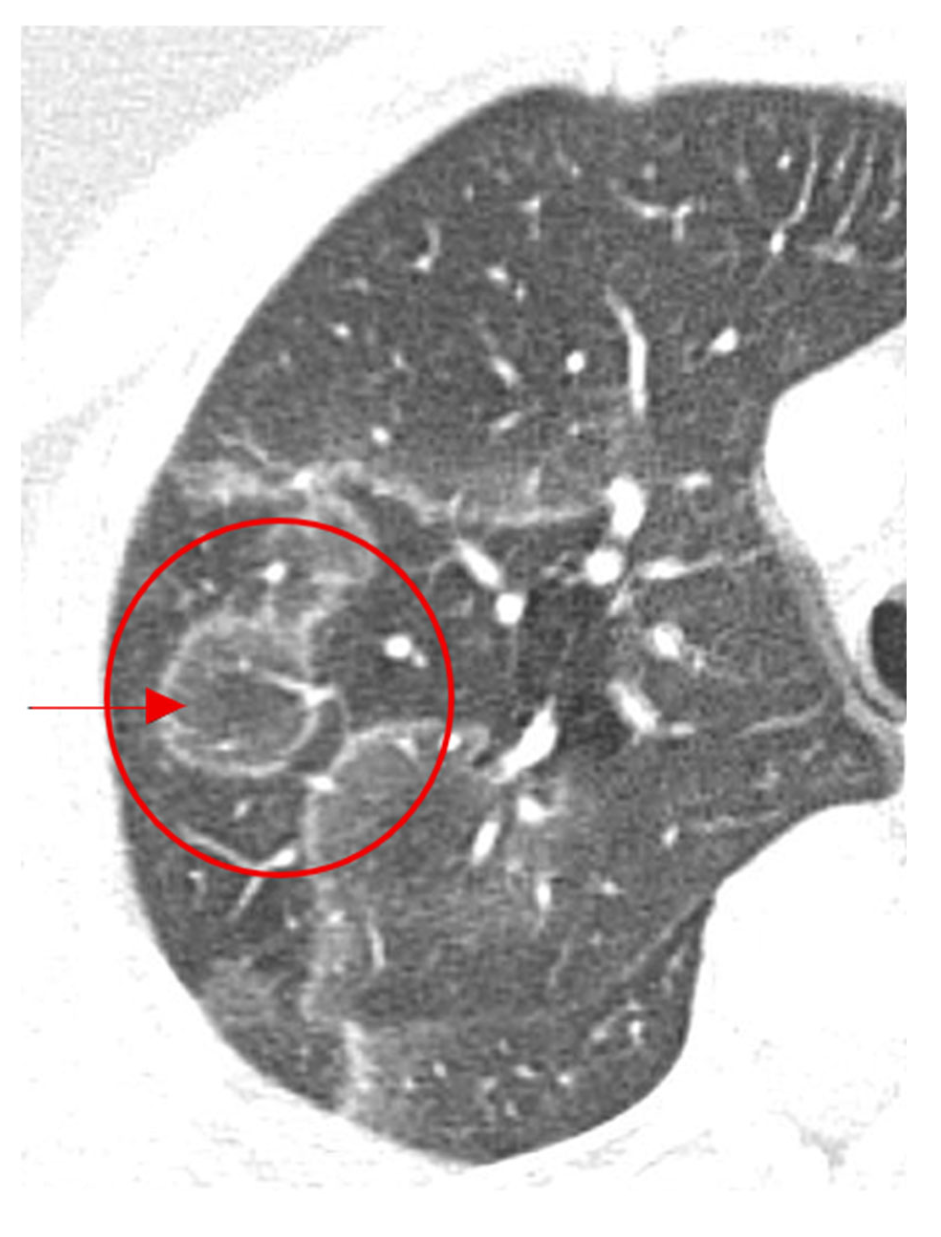 Diagnostics 15 02528 g017 Diagnostics 15 02528 g017