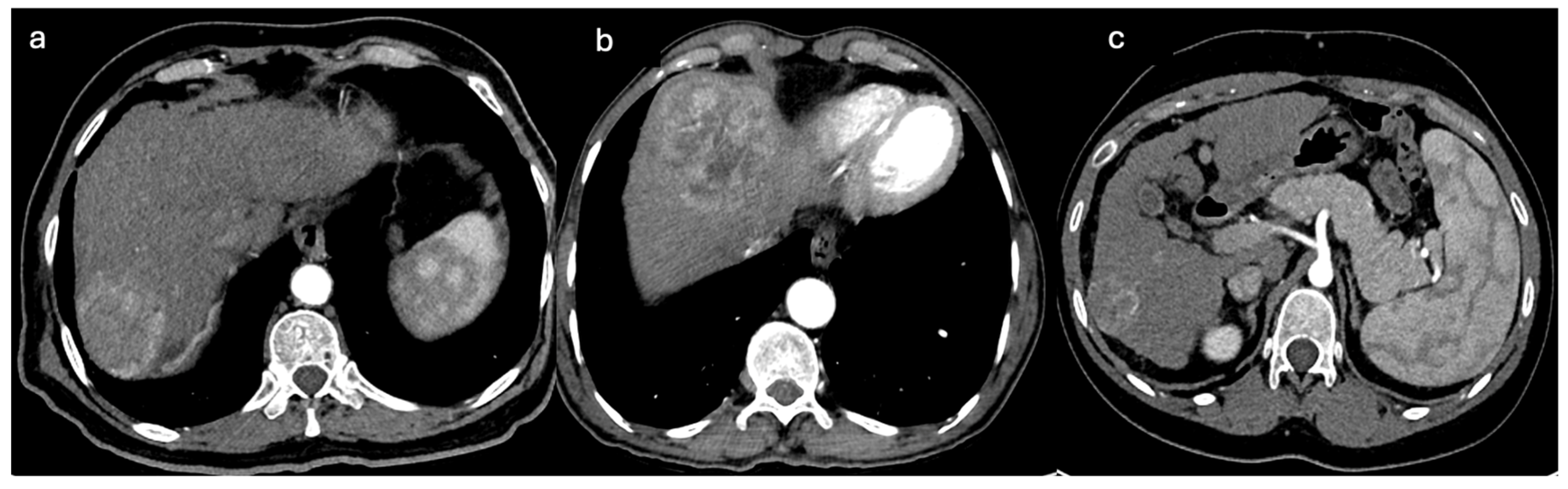 Diagnostics 15 02533 g005 Diagnostics 15 02533 g005