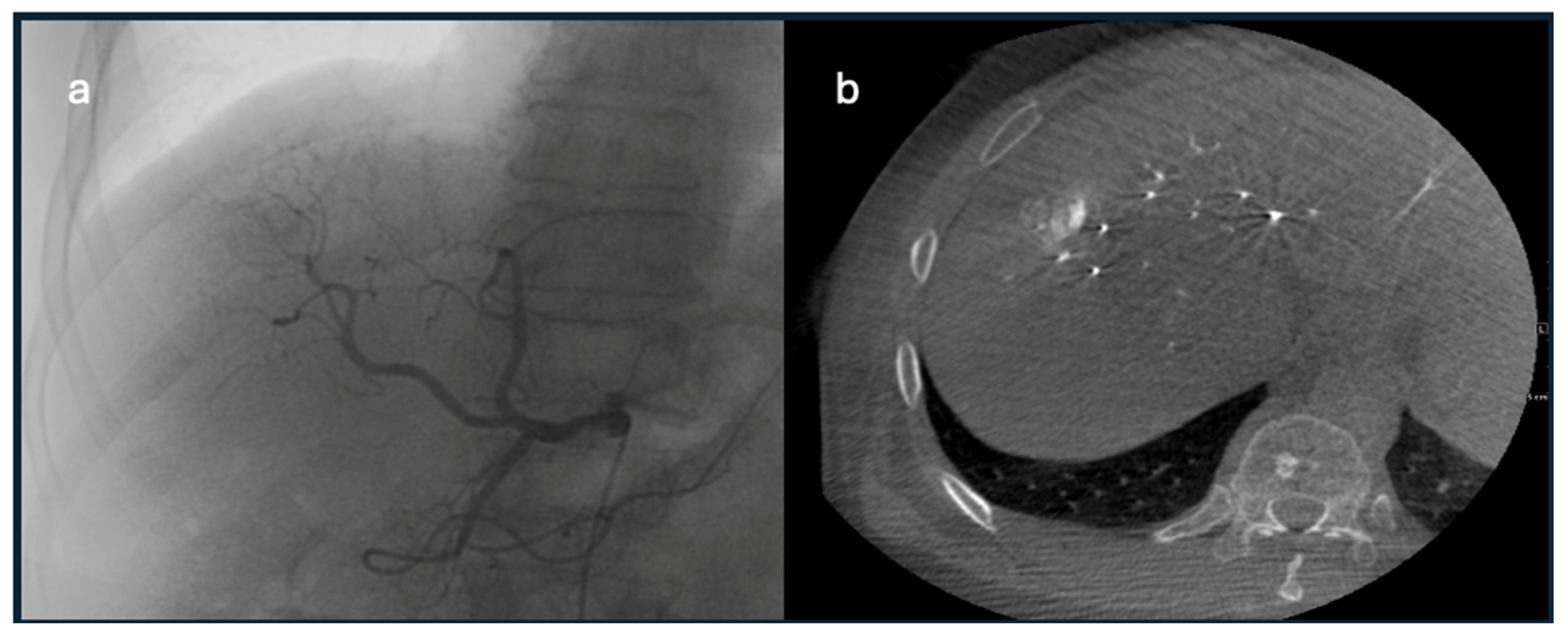 Diagnostics 15 02533 g006 Diagnostics 15 02533 g006