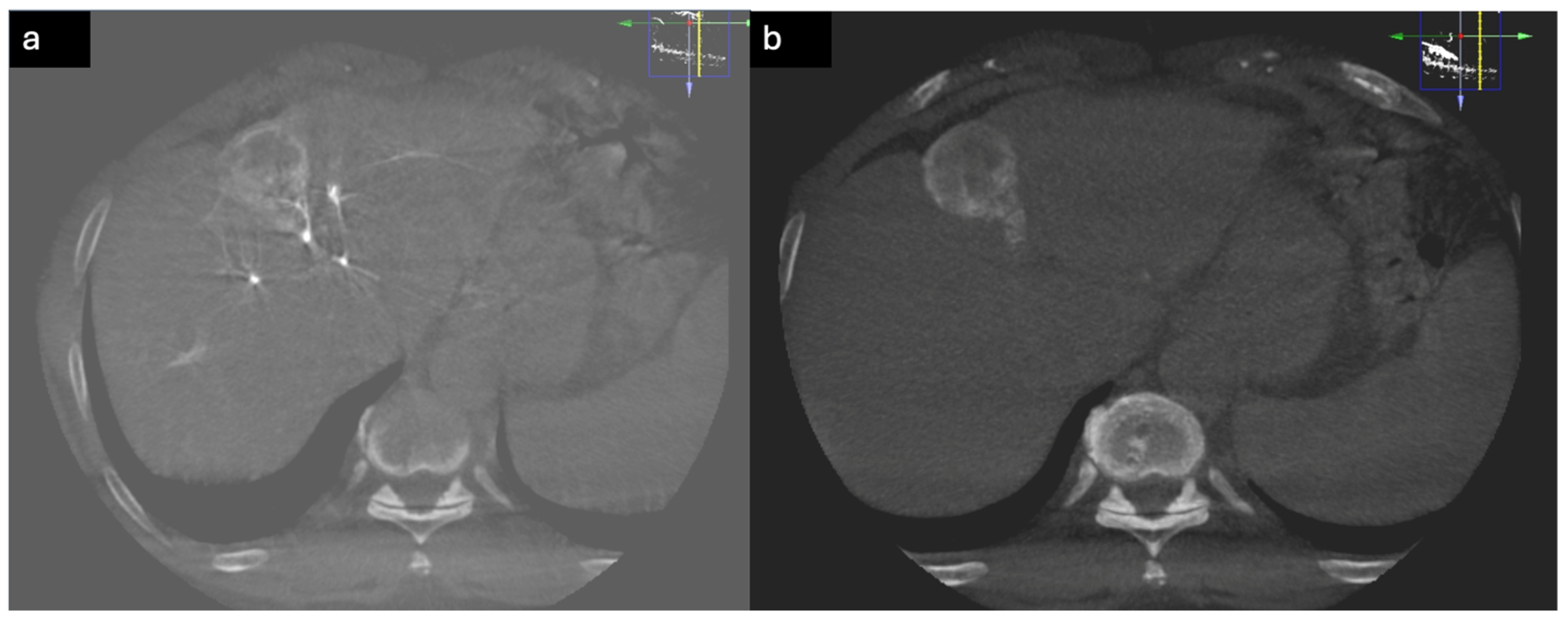 Diagnostics 15 02533 g007 Diagnostics 15 02533 g007