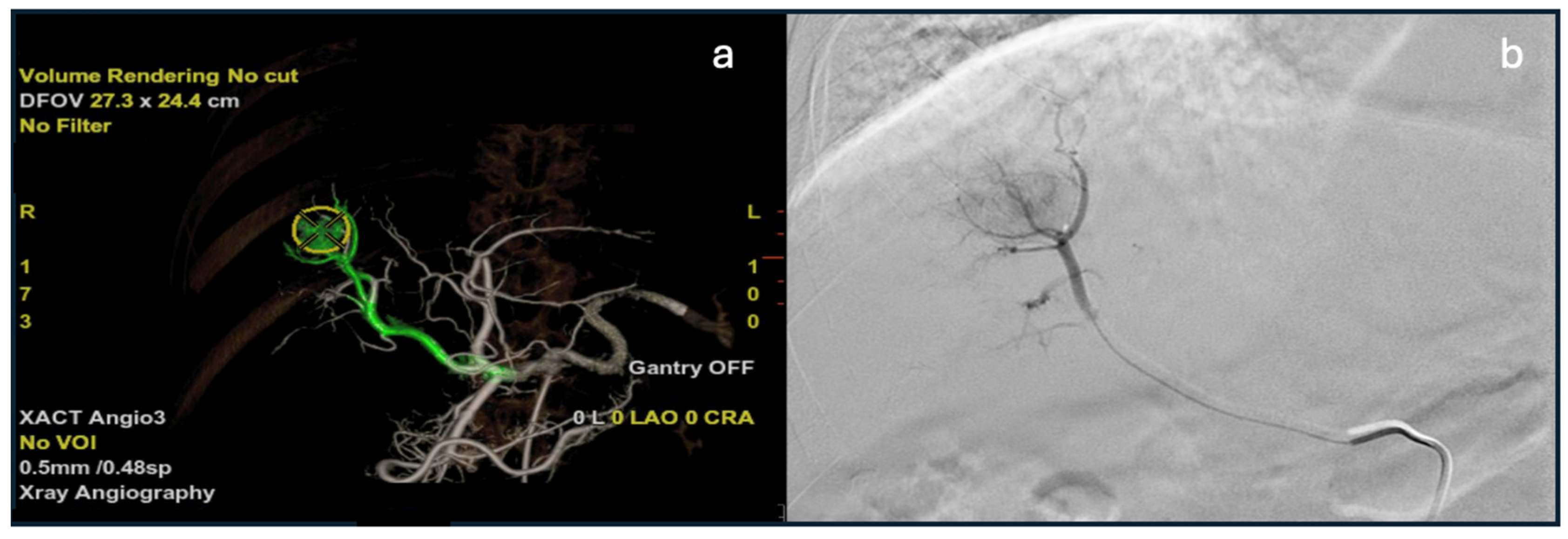Diagnostics 15 02533 g008 Diagnostics 15 02533 g008