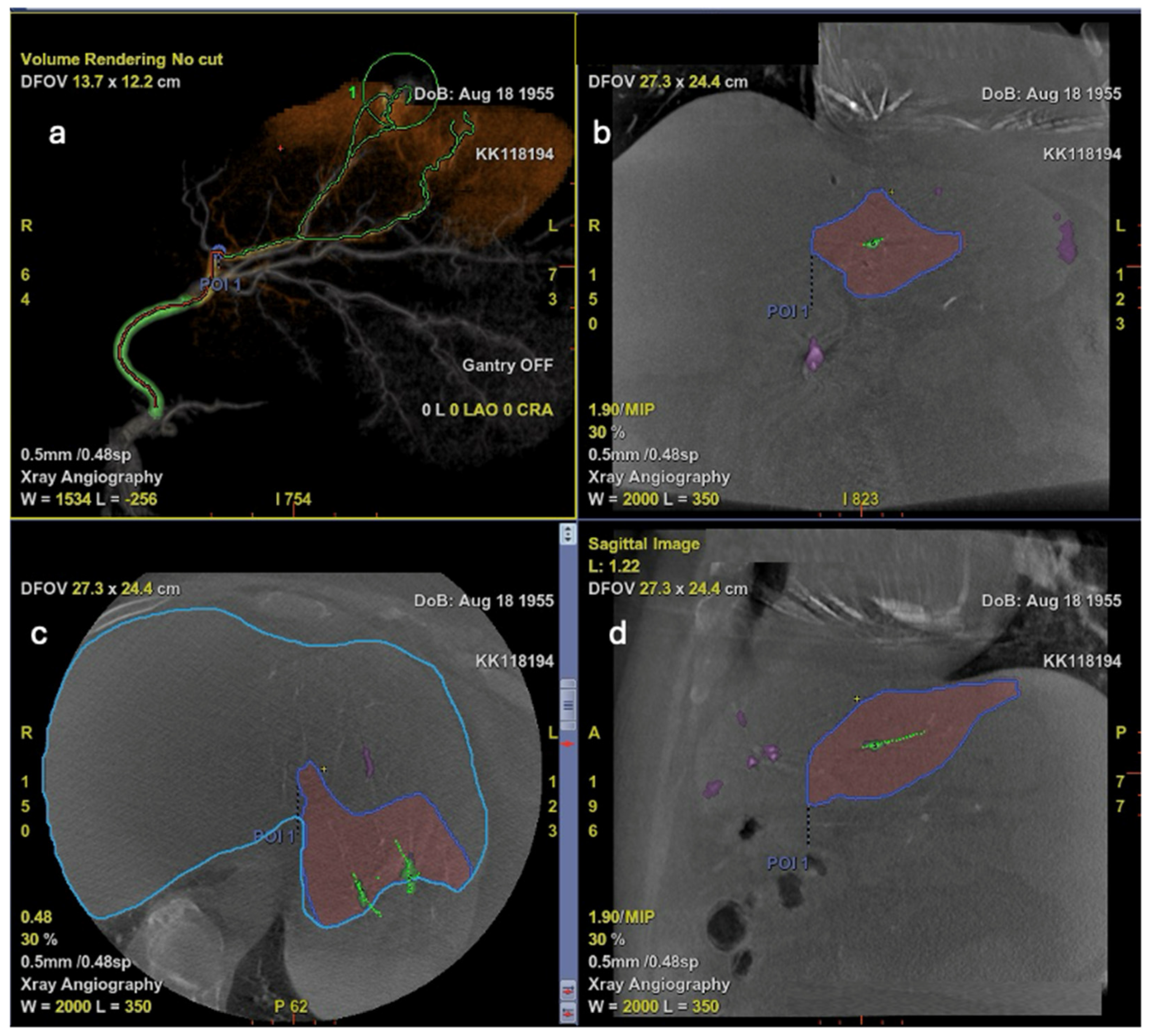 Diagnostics 15 02533 g009 Diagnostics 15 02533 g009
