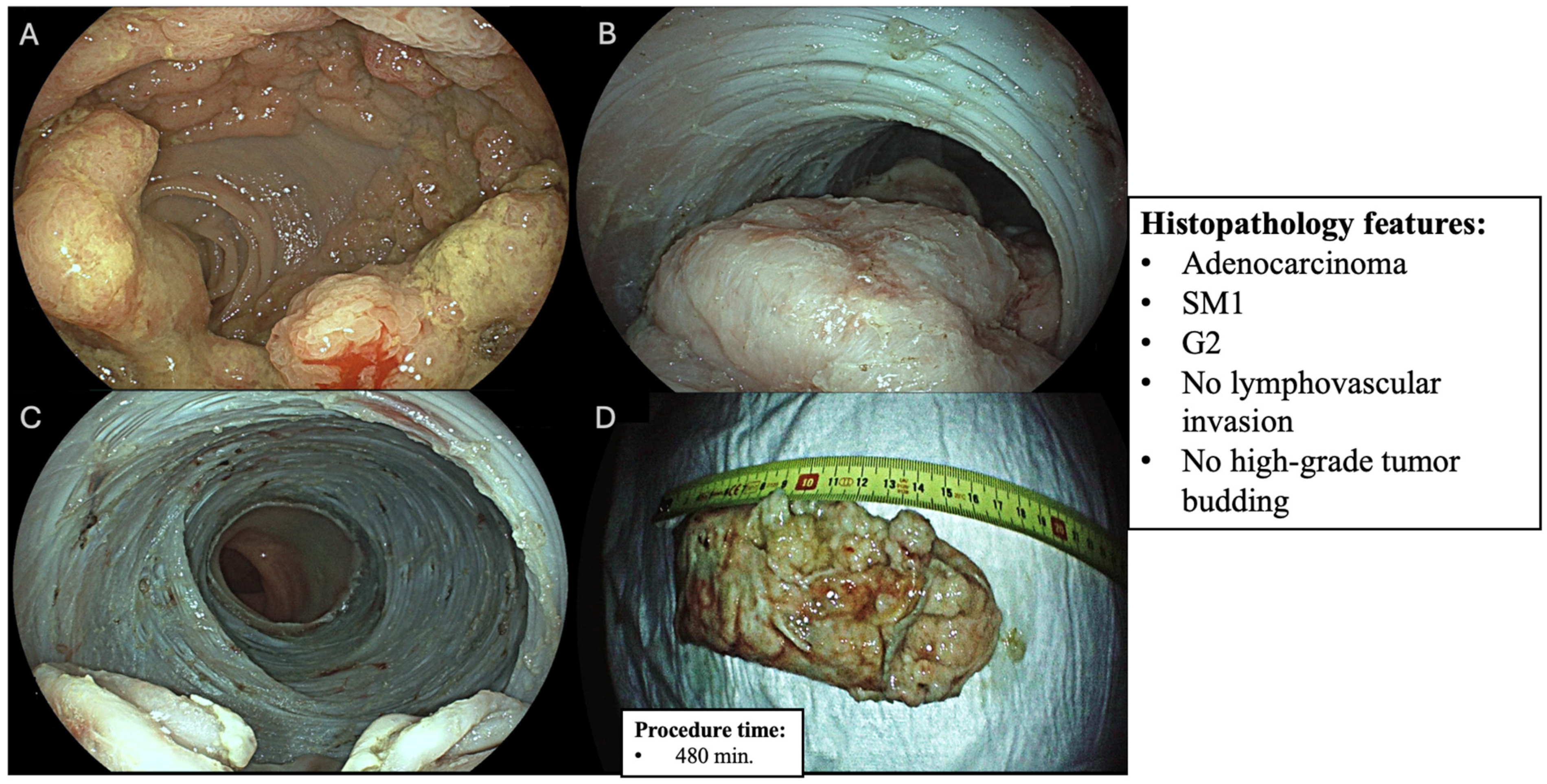 Diagnostics 15 02534 g002 Diagnostics 15 02534 g002