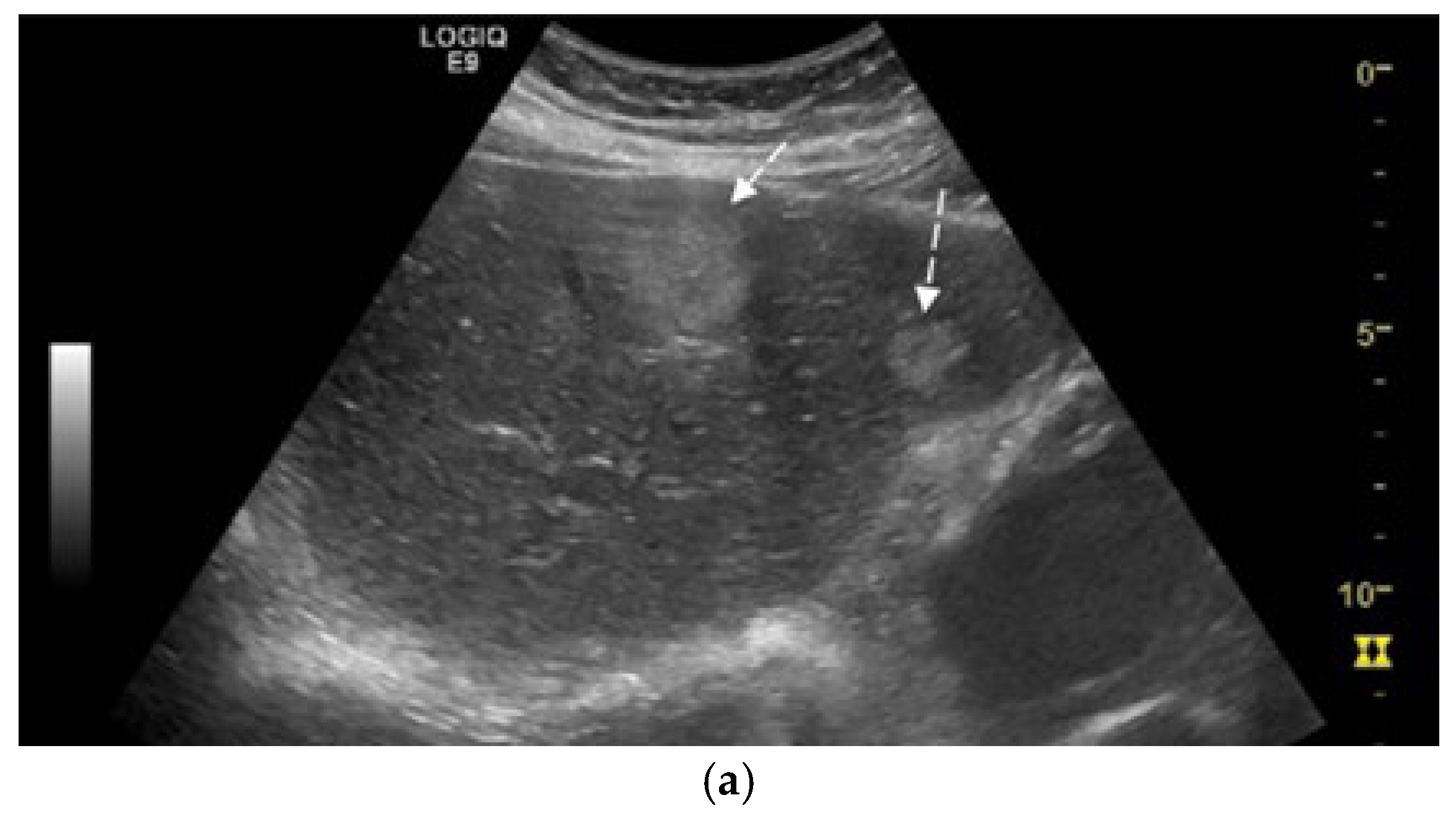 Diagnostics 15 02535 g001a Diagnostics 15 02535 g001a