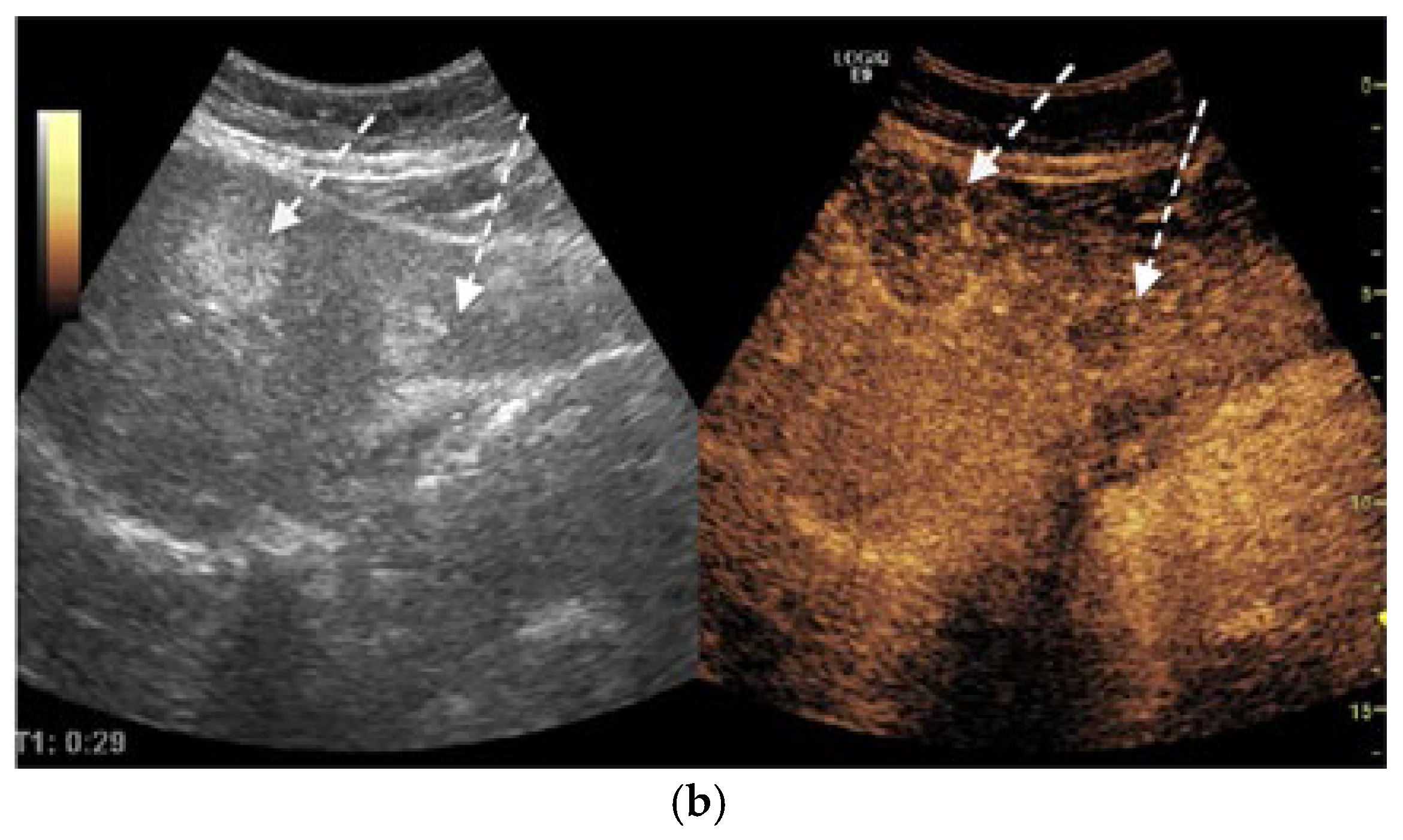 Diagnostics 15 02535 g001b Diagnostics 15 02535 g001b
