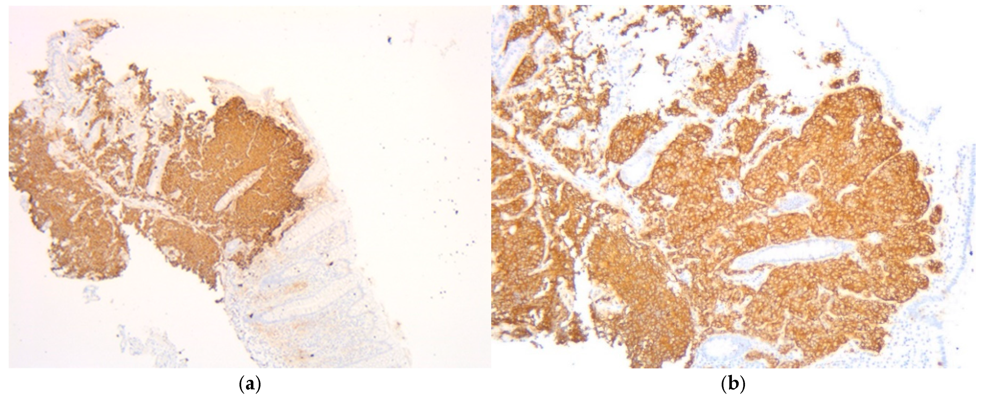 Diagnostics 15 02535 g003 Diagnostics 15 02535 g003