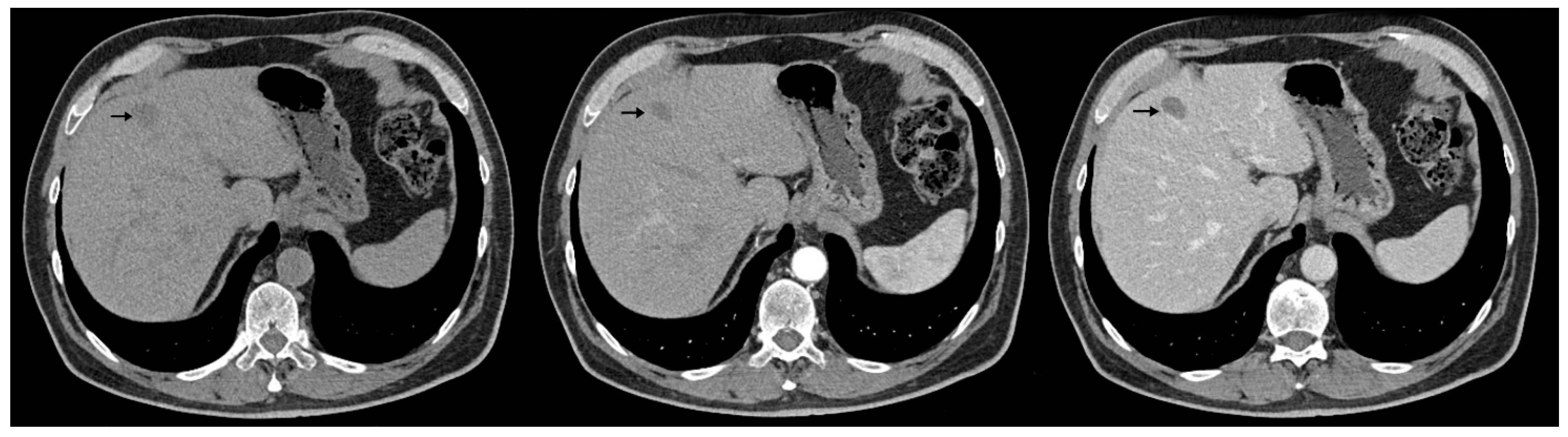 Diagnostics 15 02535 g006 Diagnostics 15 02535 g006