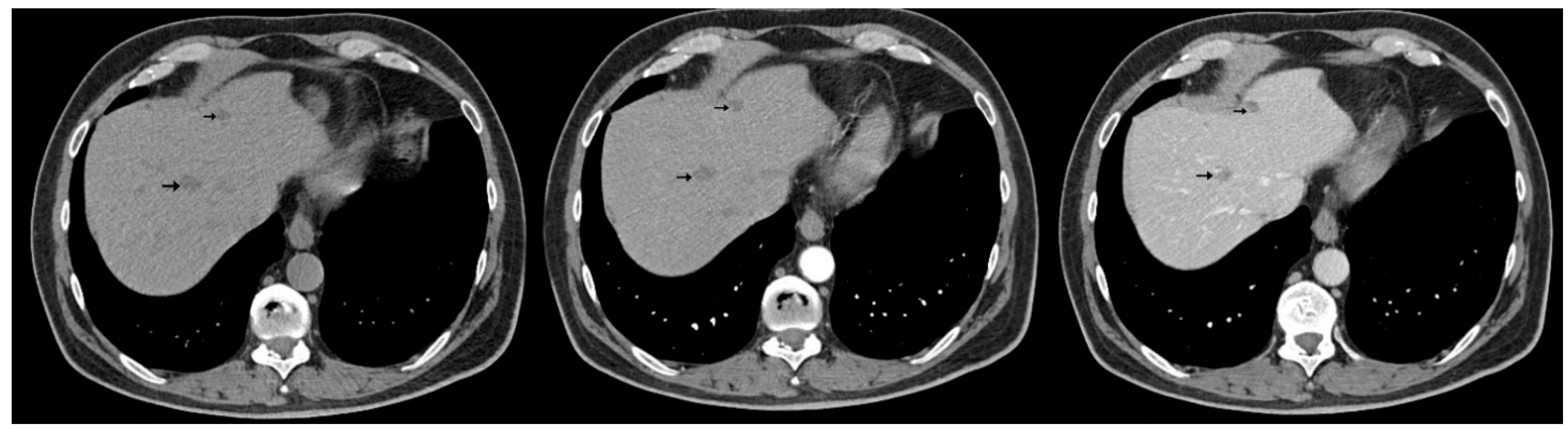 Diagnostics 15 02535 g007 Diagnostics 15 02535 g007