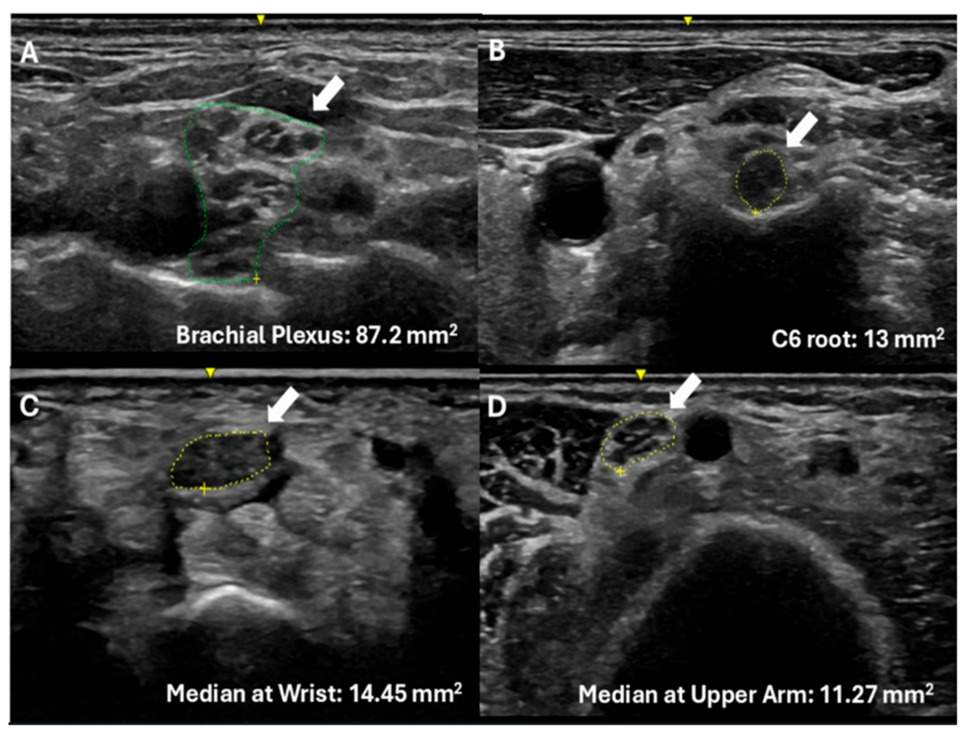 Diagnostics 15 02556 g001 Diagnostics 15 02556 g001