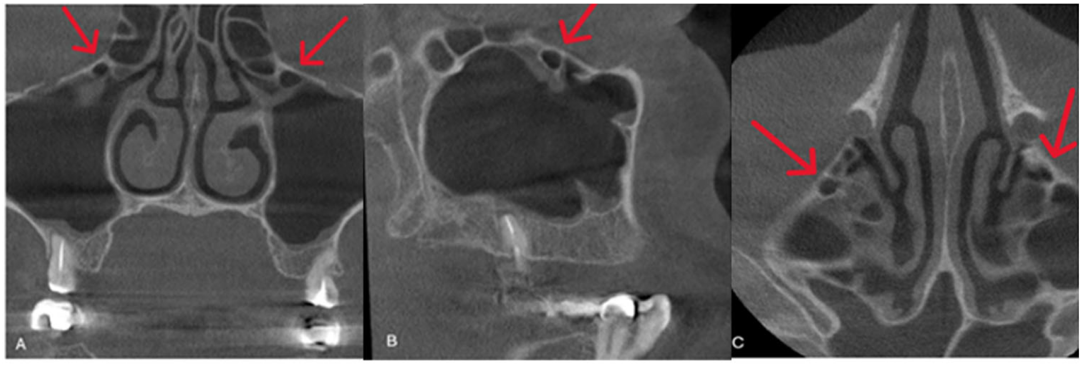 Diagnostics 15 02557 g001 Diagnostics 15 02557 g001