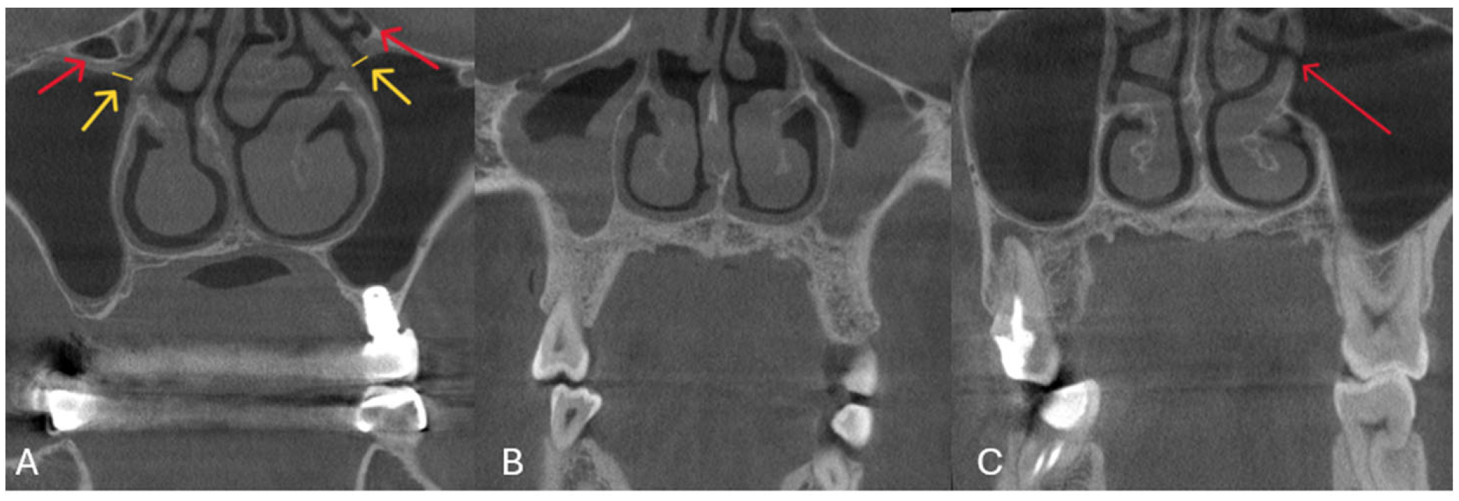 Diagnostics 15 02557 g002 Diagnostics 15 02557 g002