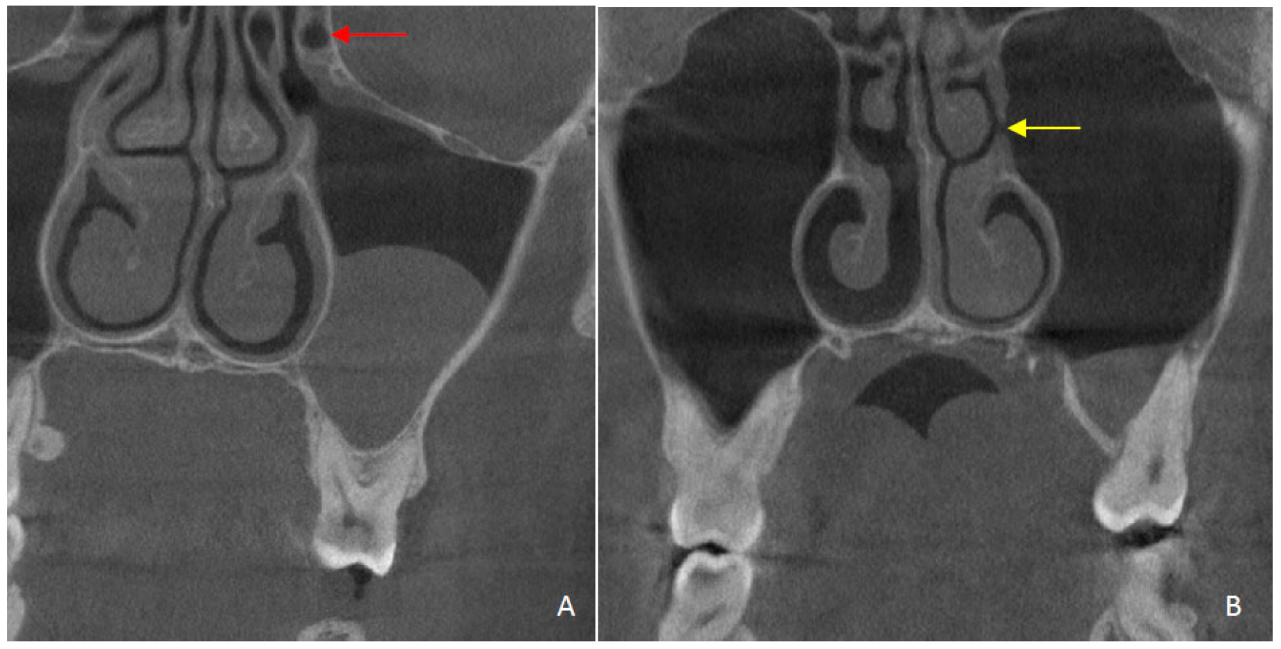 Diagnostics 15 02557 g004 Diagnostics 15 02557 g004