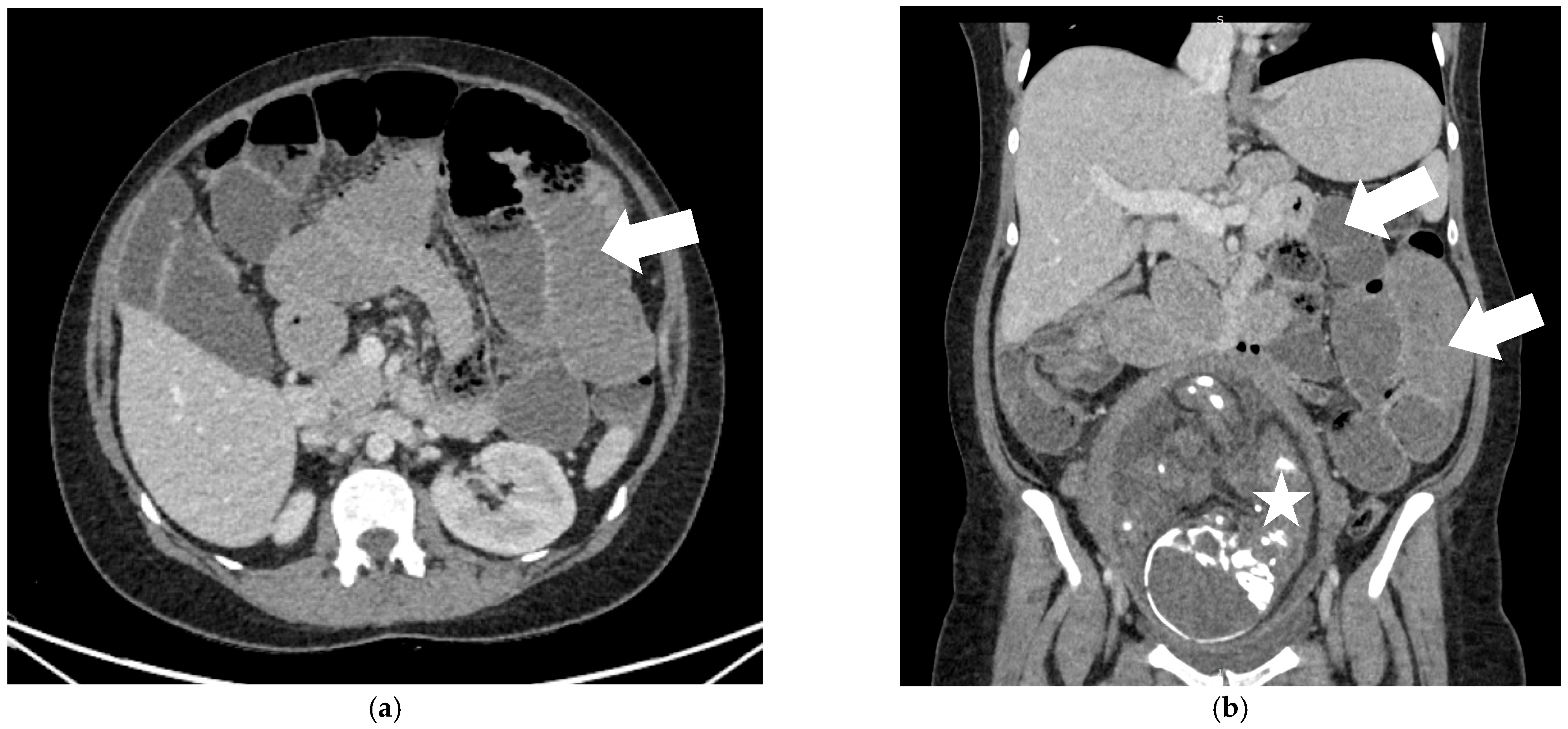 Diagnostics 15 02593 g001 Diagnostics 15 02593 g001