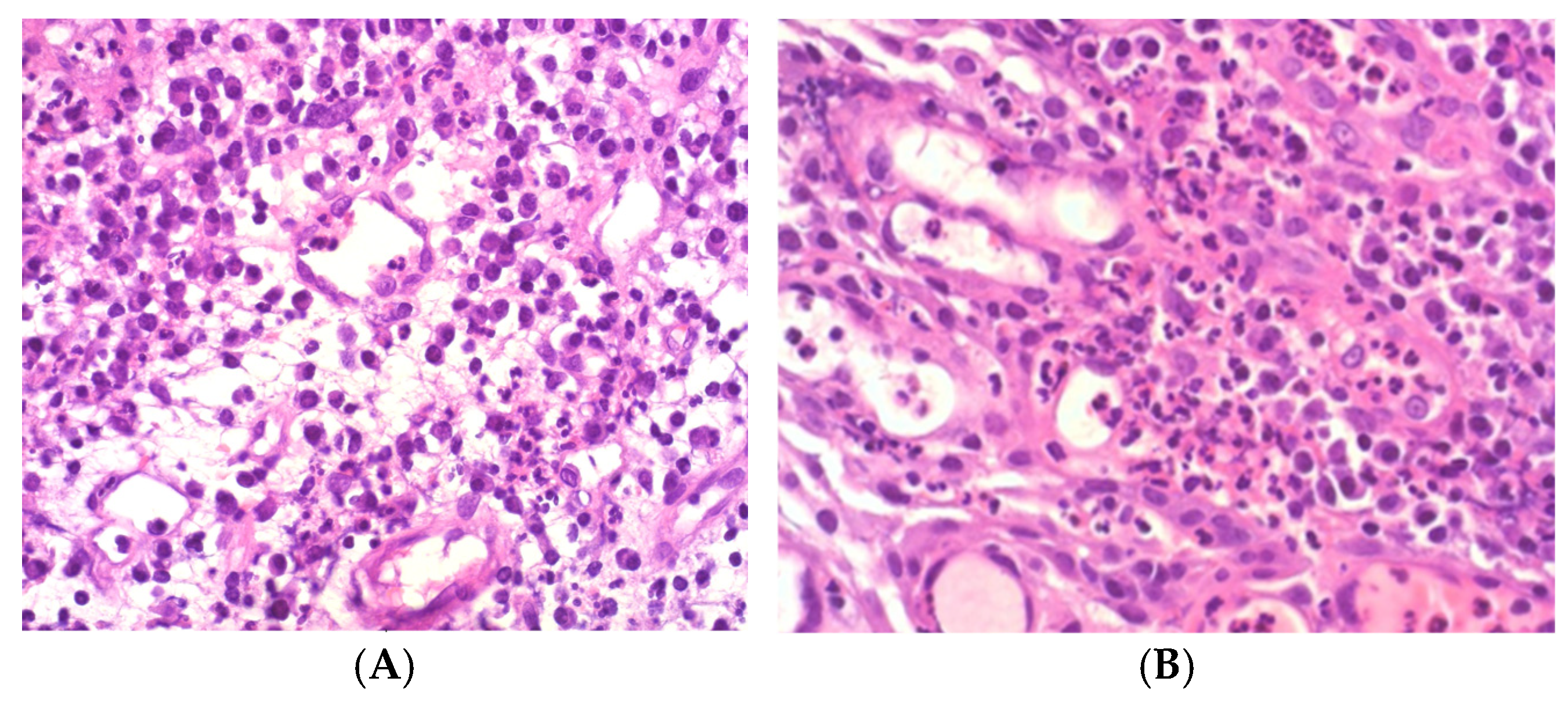 Diagnostics 15 02597 g003 Diagnostics 15 02597 g003