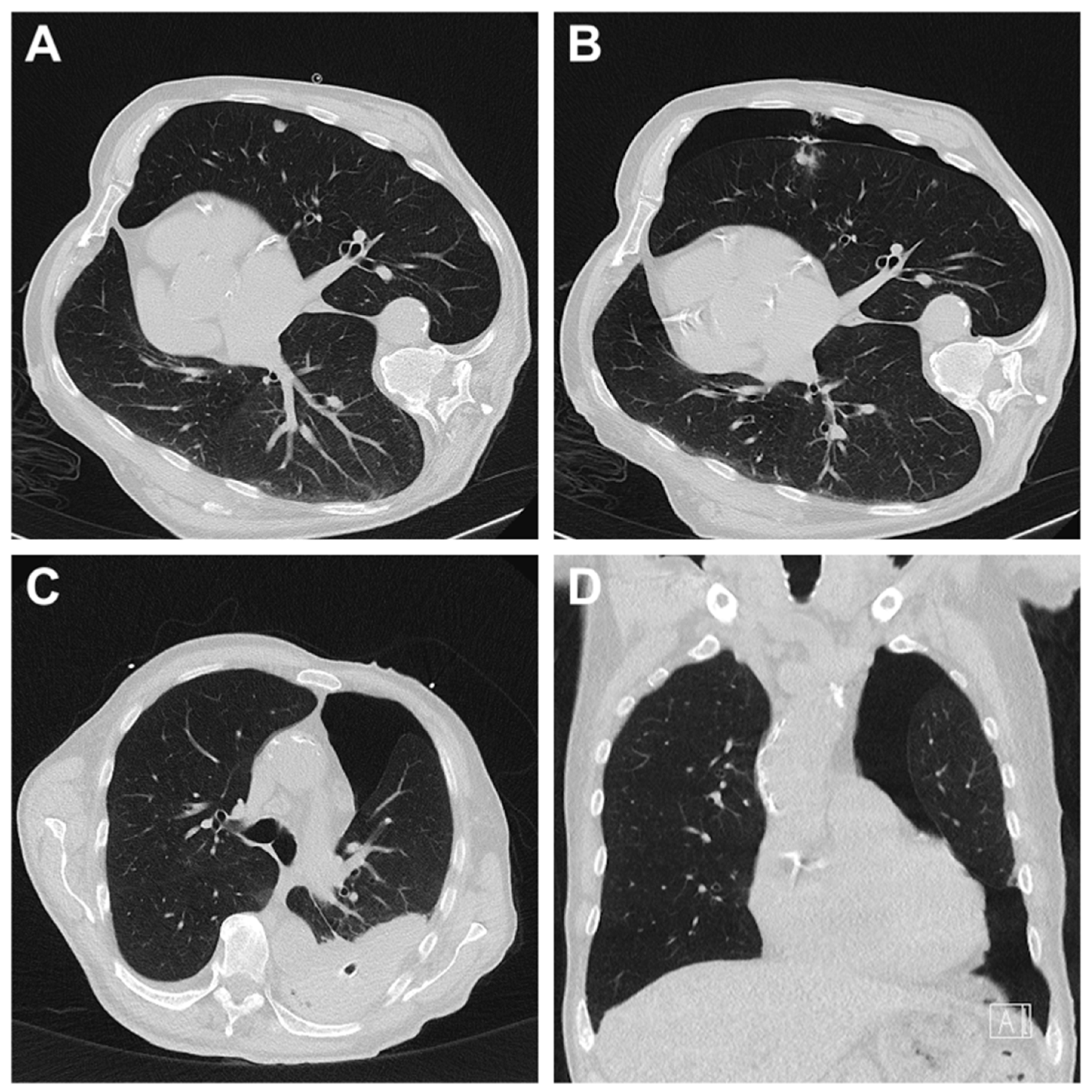 Diagnostics 15 02641 g002 Diagnostics 15 02641 g002