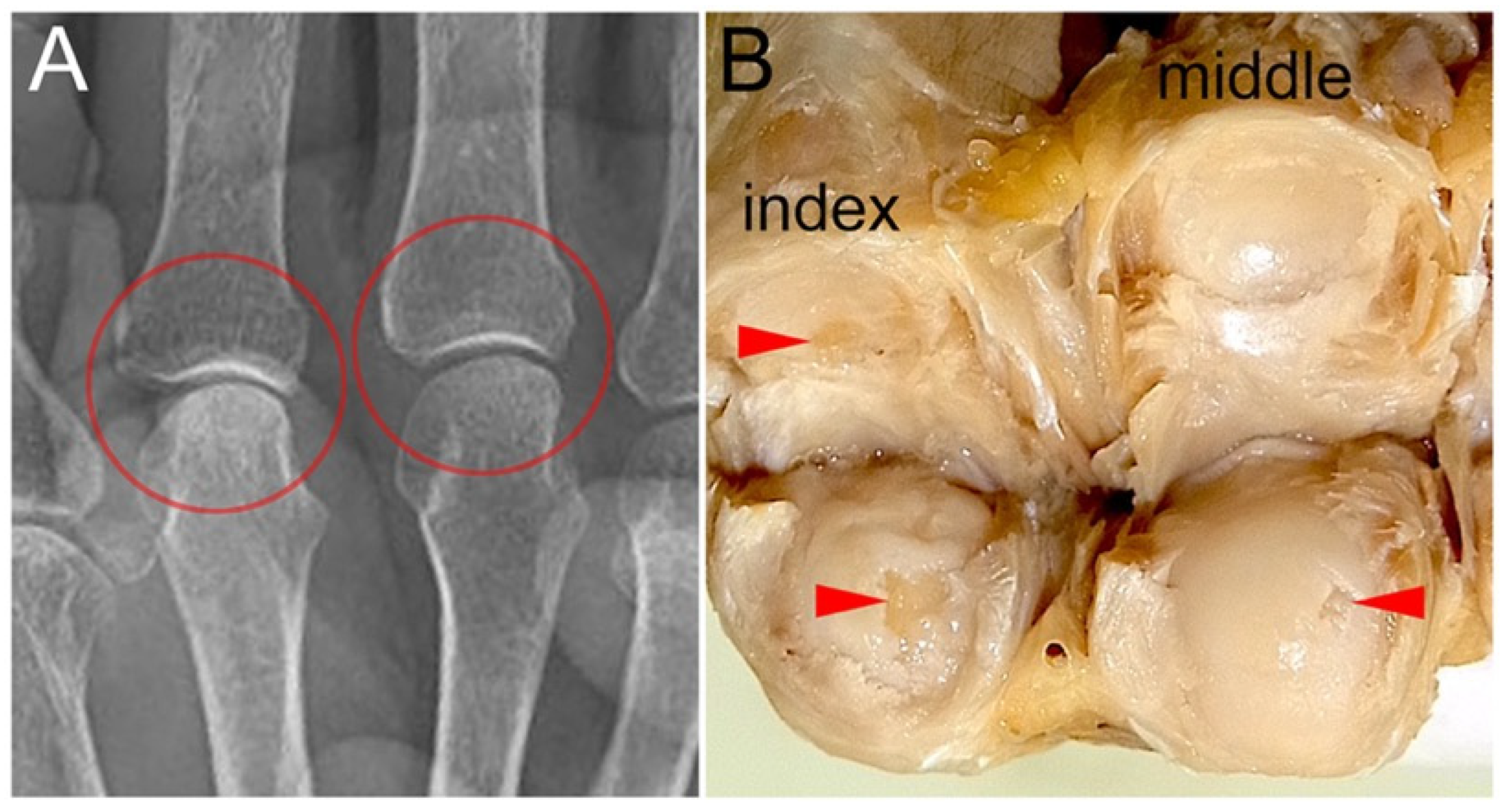 Diagnostics 15 02669 g004 Diagnostics 15 02669 g004