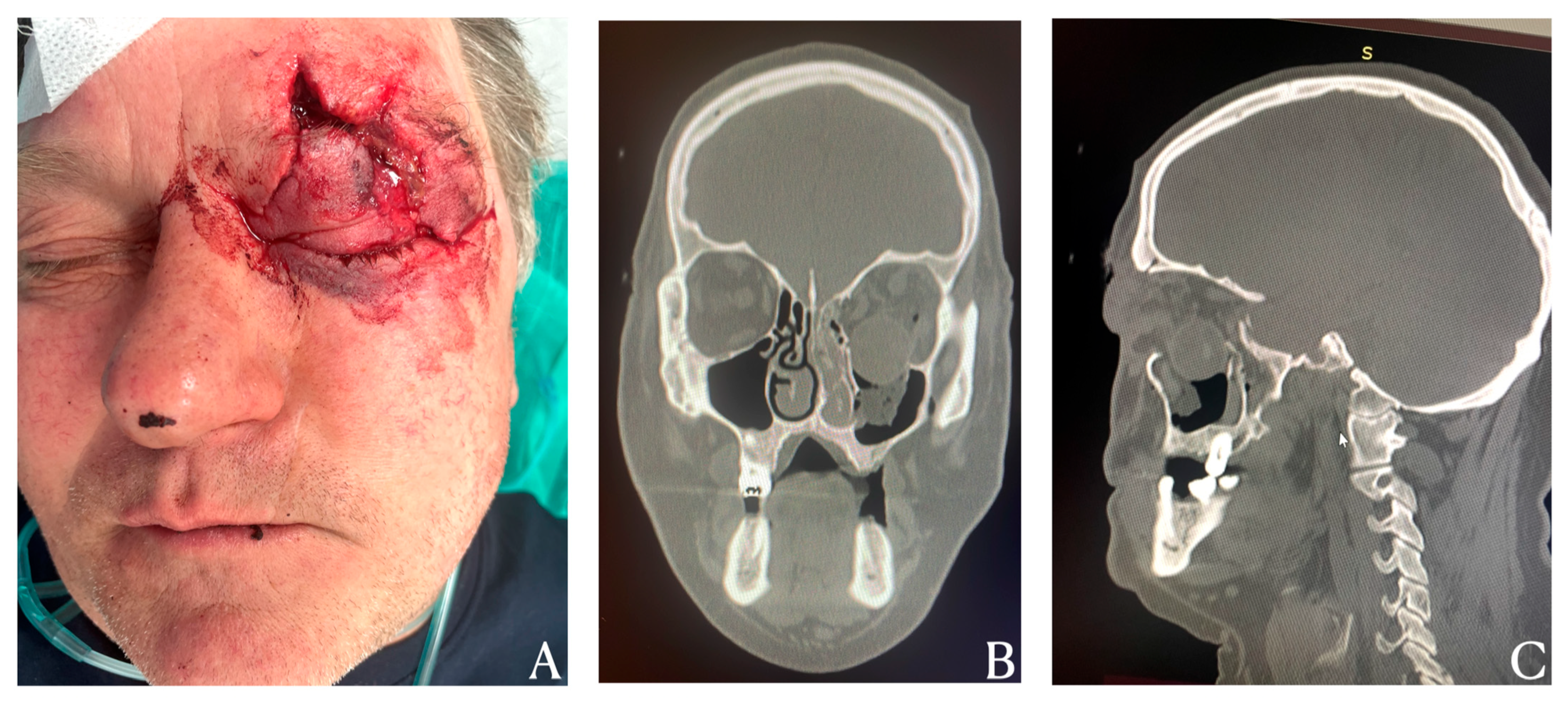 Diagnostics 15 02705 g001 Diagnostics 15 02705 g001