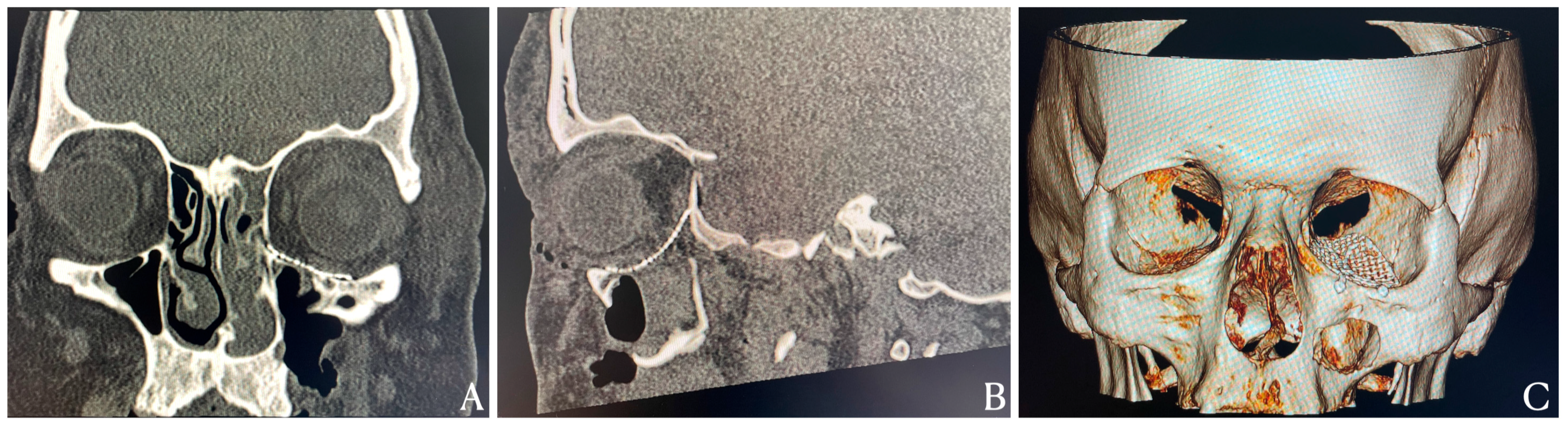 Diagnostics 15 02705 g003 Diagnostics 15 02705 g003