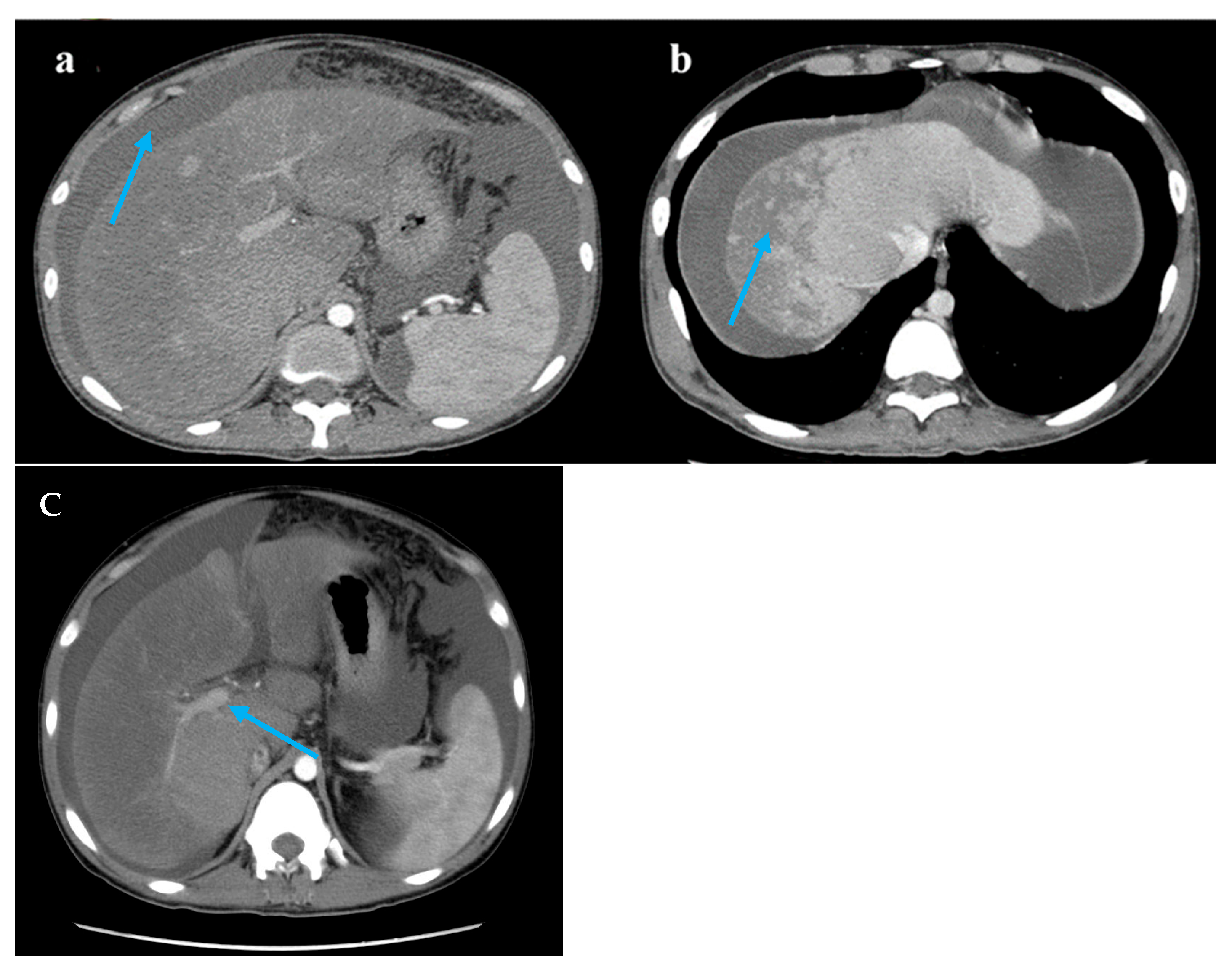 Diagnostics 15 02712 g001