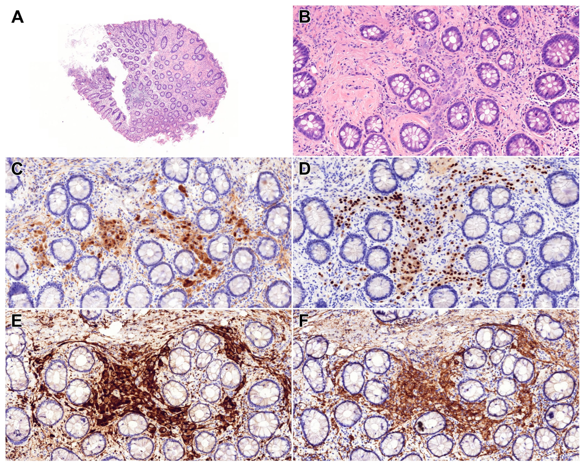 Diagnostics 15 02716 g001 Diagnostics 15 02716 g001