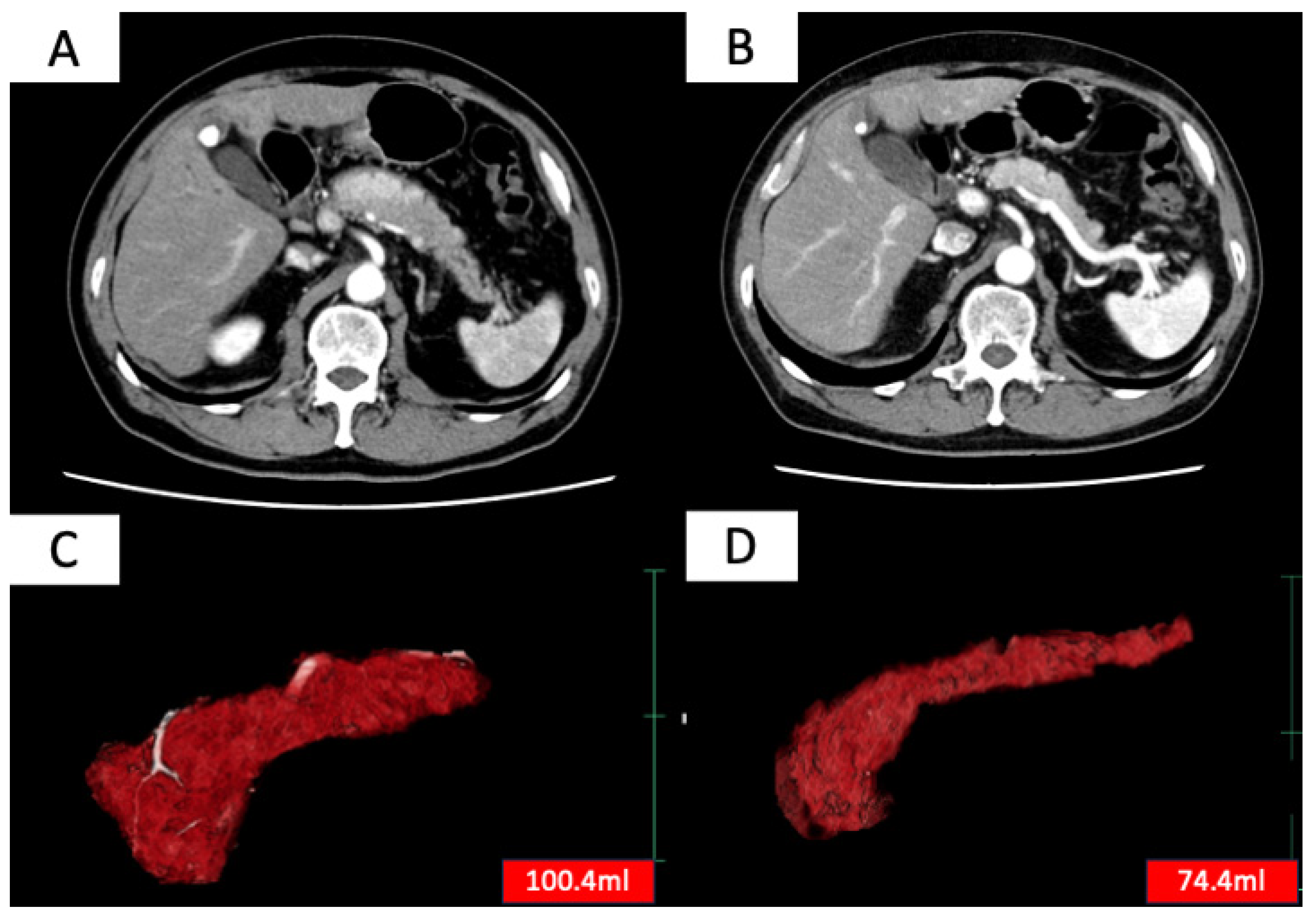 Diagnostics 15 02719 g001 Diagnostics 15 02719 g001