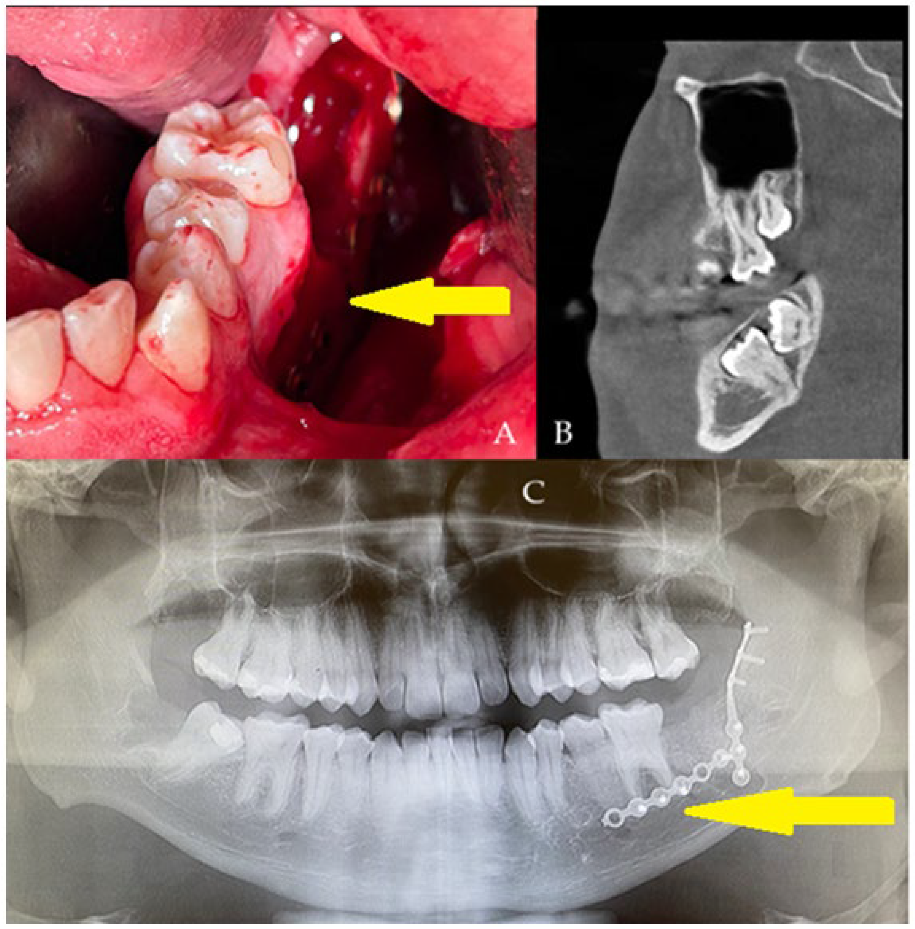 Diagnostics 15 02724 g002 Diagnostics 15 02724 g002