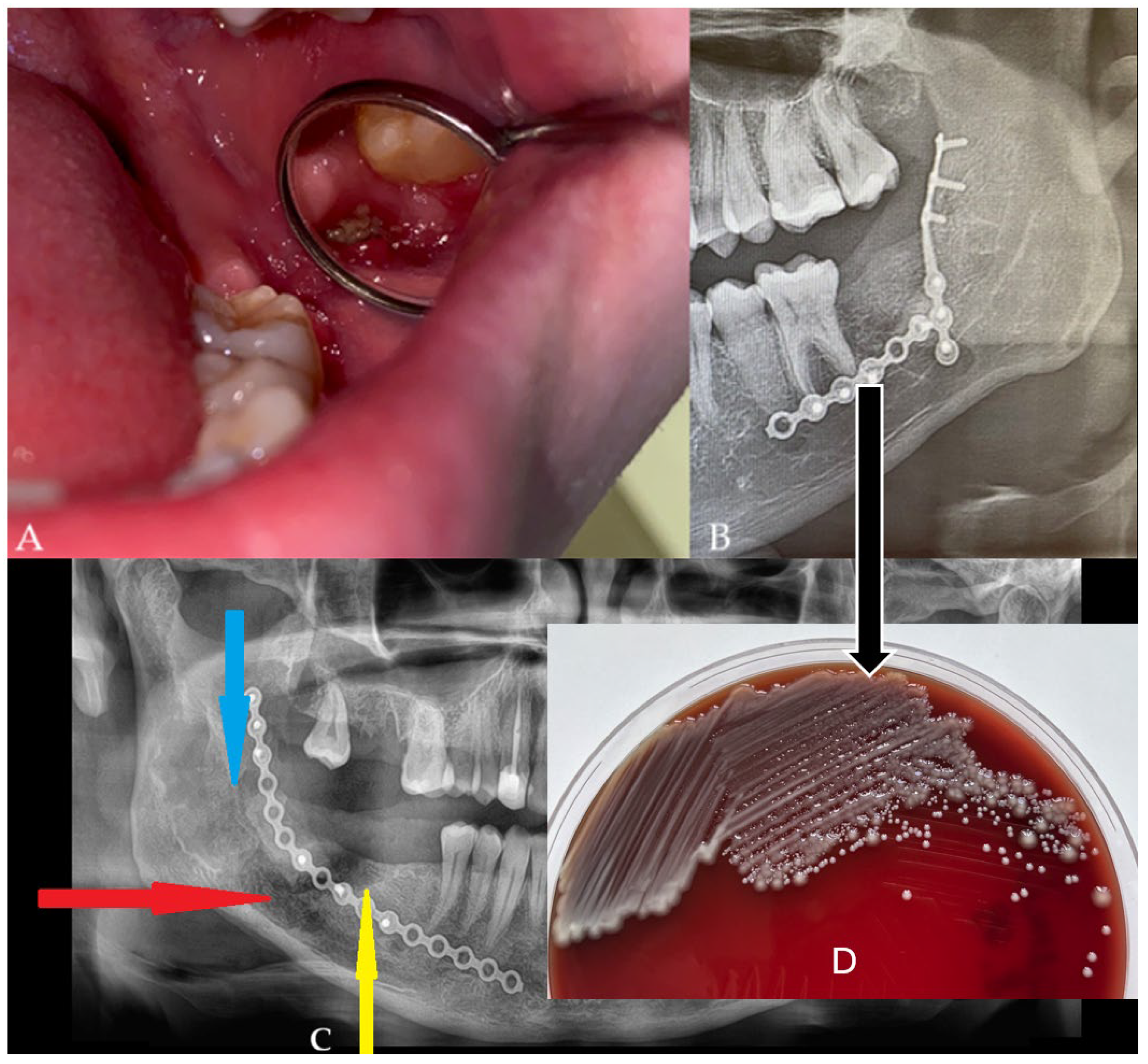 Diagnostics 15 02724 g003 Diagnostics 15 02724 g003