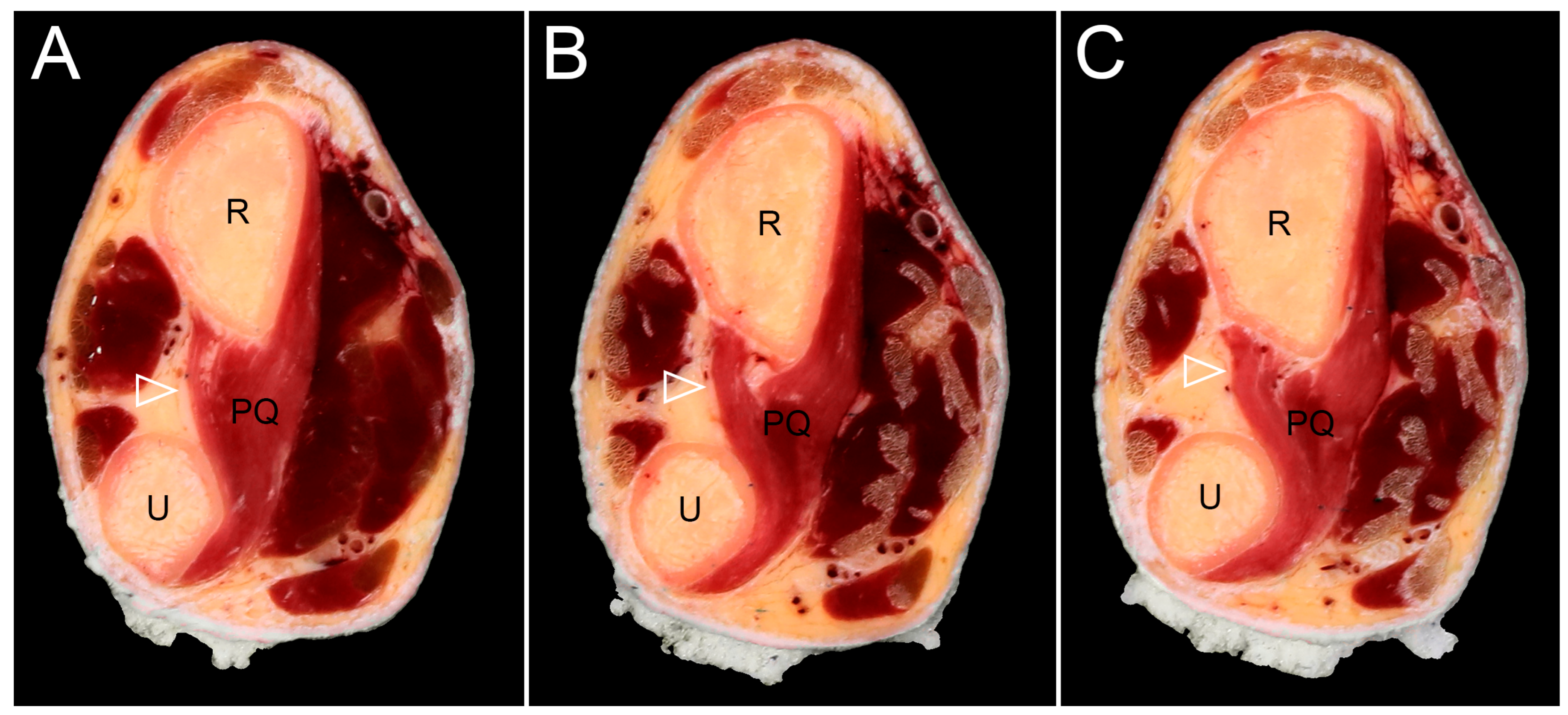 Diagnostics 15 02728 g003 Diagnostics 15 02728 g003