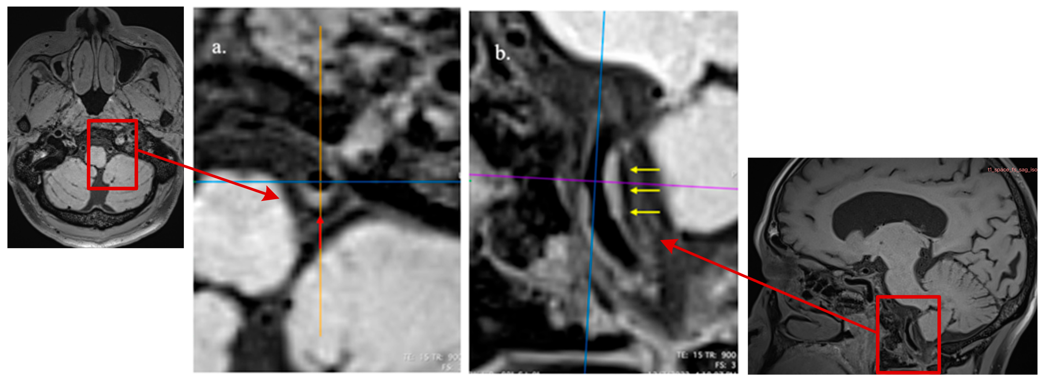 Diagnostics 15 02731 g003 Diagnostics 15 02731 g003