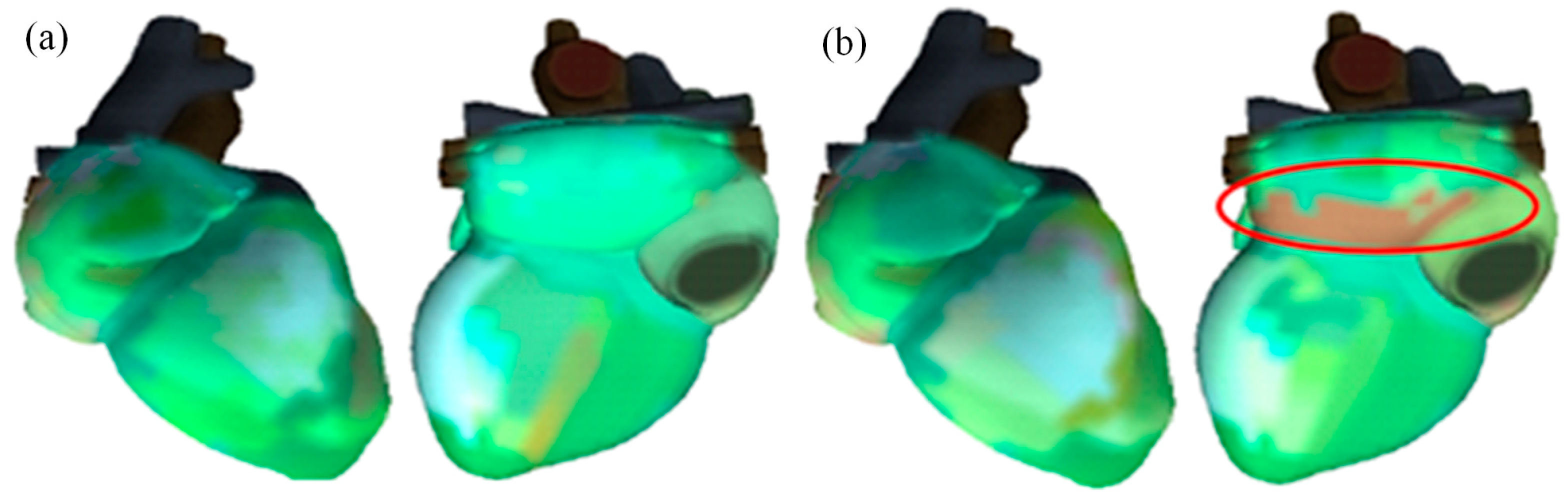 Diagnostics 15 02731 g004 Diagnostics 15 02731 g004