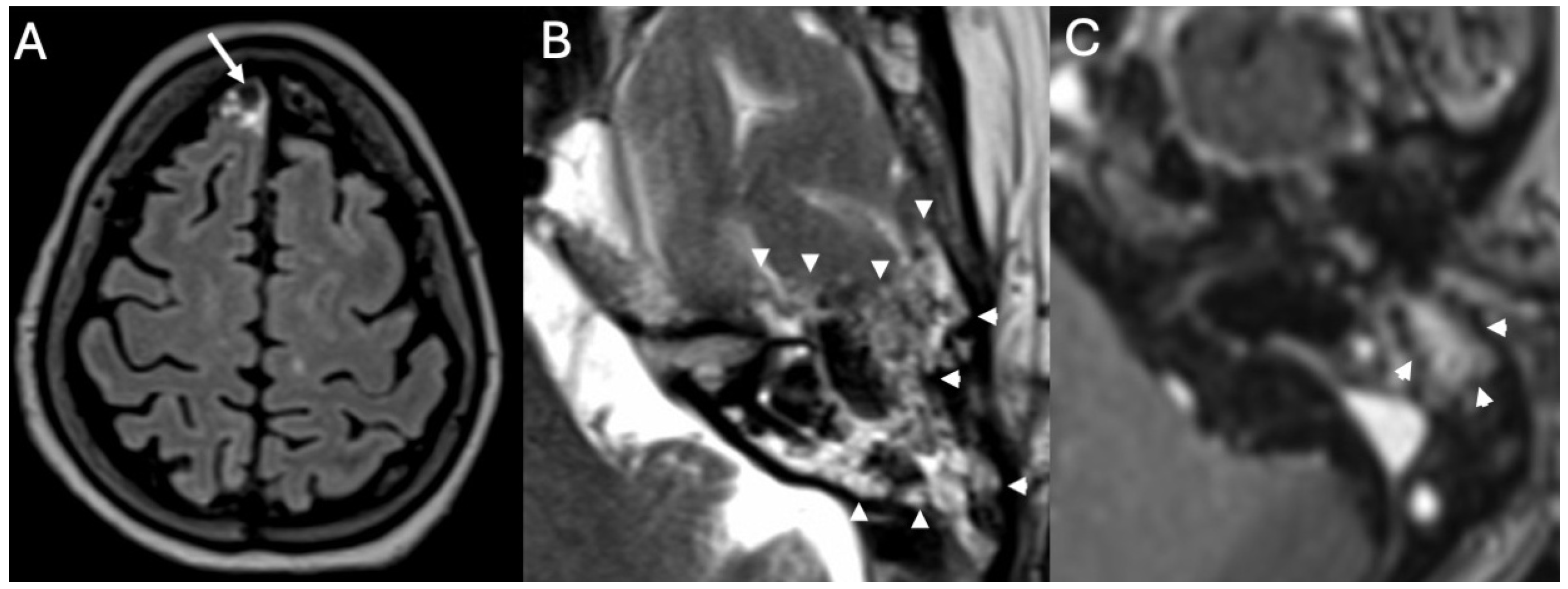 Diagnostics 15 02733 g004 Diagnostics 15 02733 g004