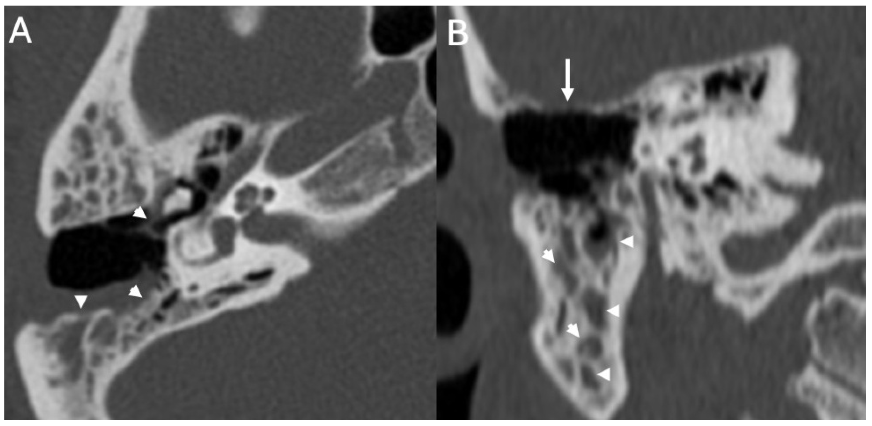 Diagnostics 15 02733 g007 Diagnostics 15 02733 g007